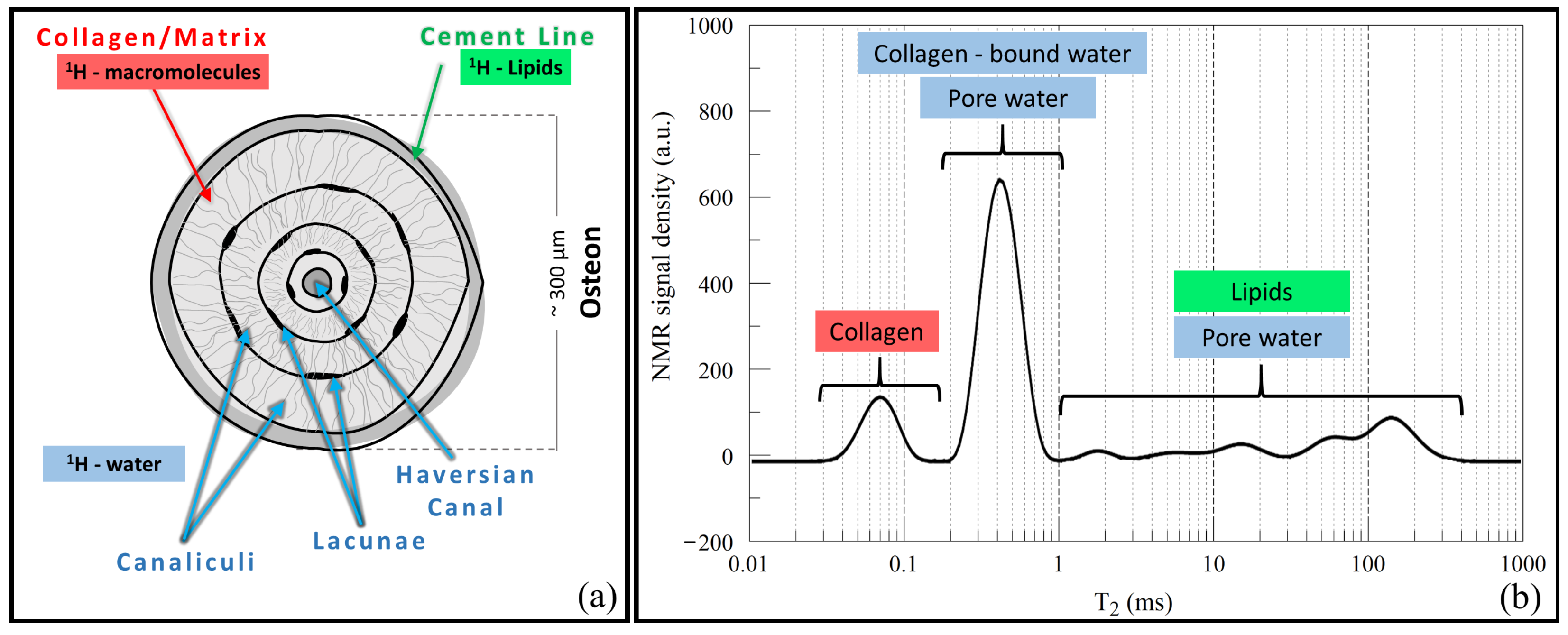 Relationship between NMR transverse relaxation, trabecular bone  architecture, and strength. - Abstract - Europe PMC