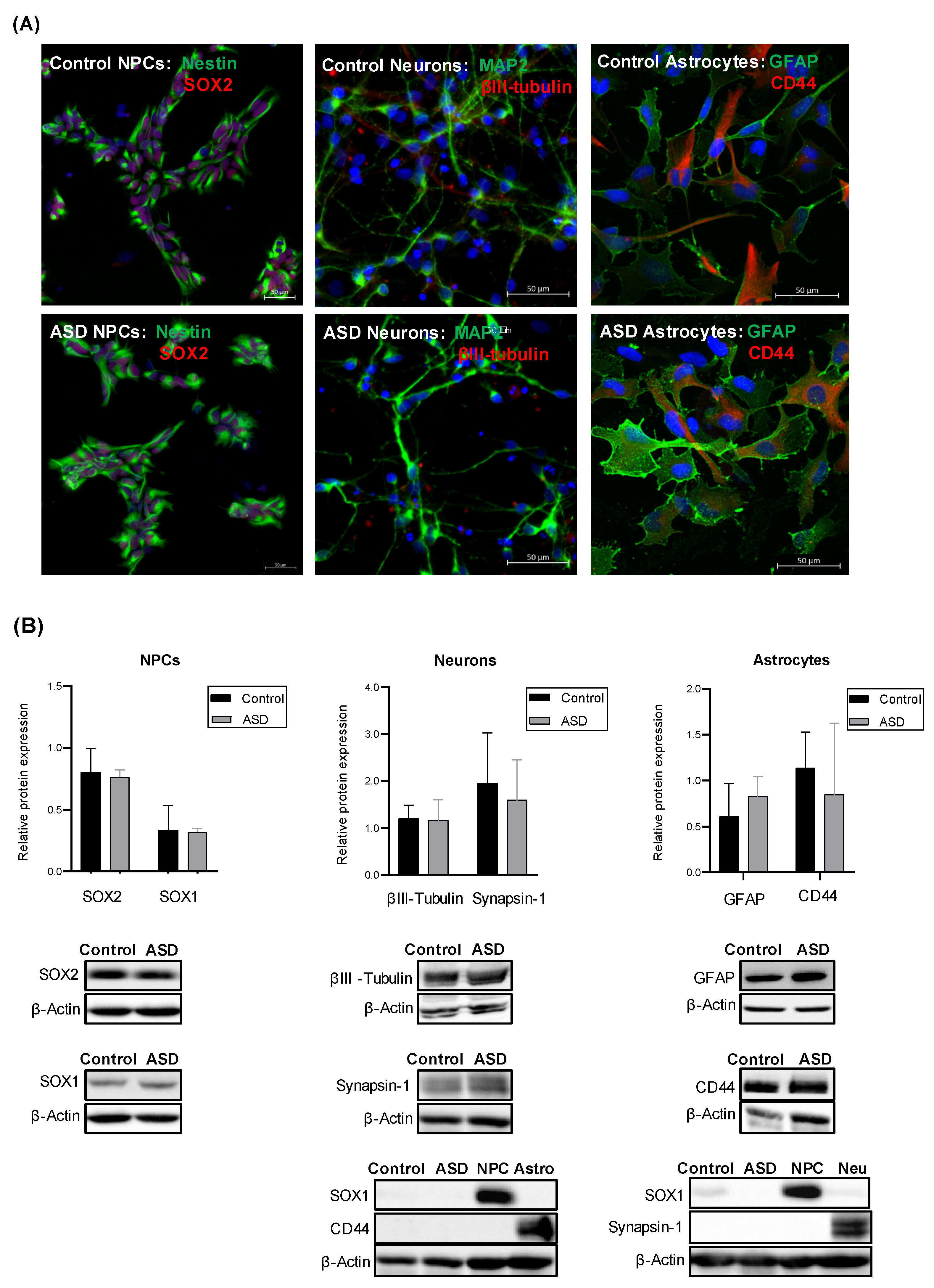 IJMS | Free Full-Text | Complement C4 Is Reduced in iPSC-Derived Astrocytes  of Autism Spectrum Disorder Subjects