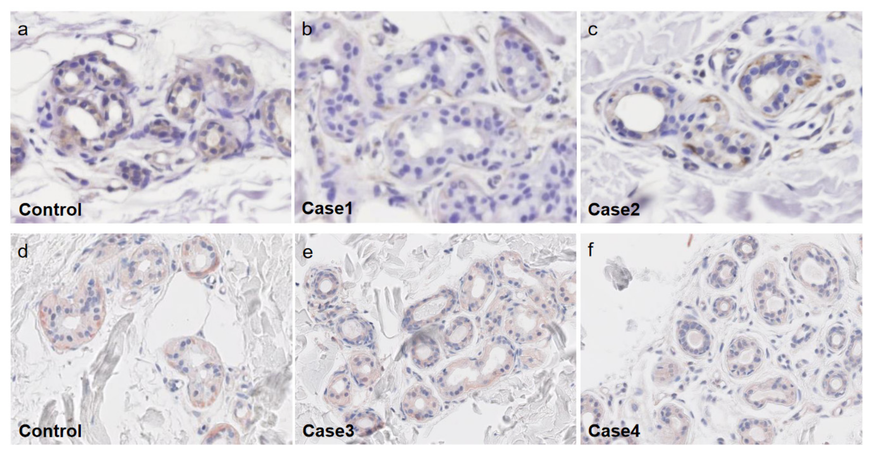 Ijms 22 08389 g004 Ijms 22 08389 g004