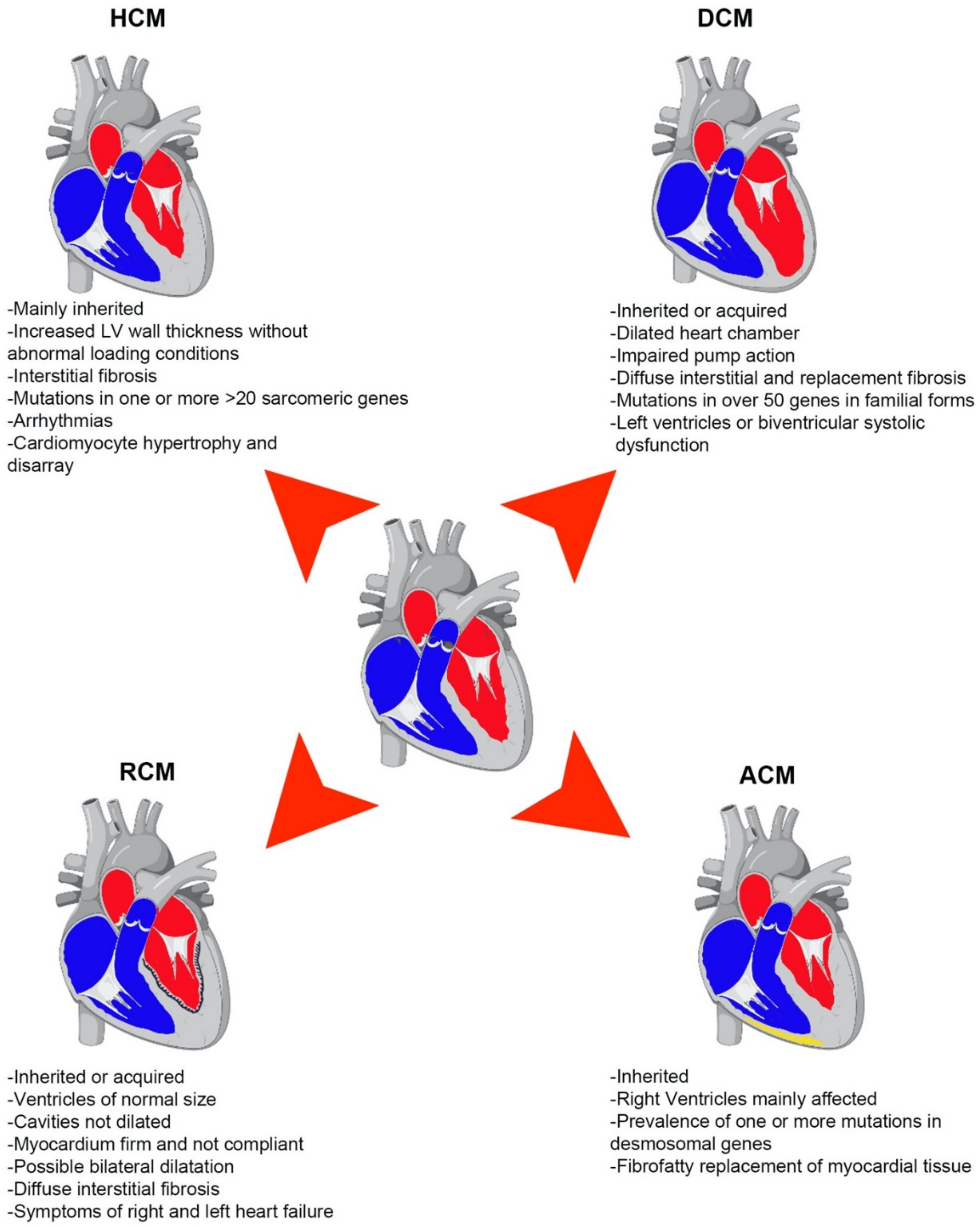 IJMS | Free Full-Text | The Emerging Role of Epigenetics in Therapeutic  Targeting of Cardiomyopathies | HTML