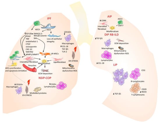 IJMS | Free Full-Text | Fibrotic Idiopathic Interstitial Lung Disease ...