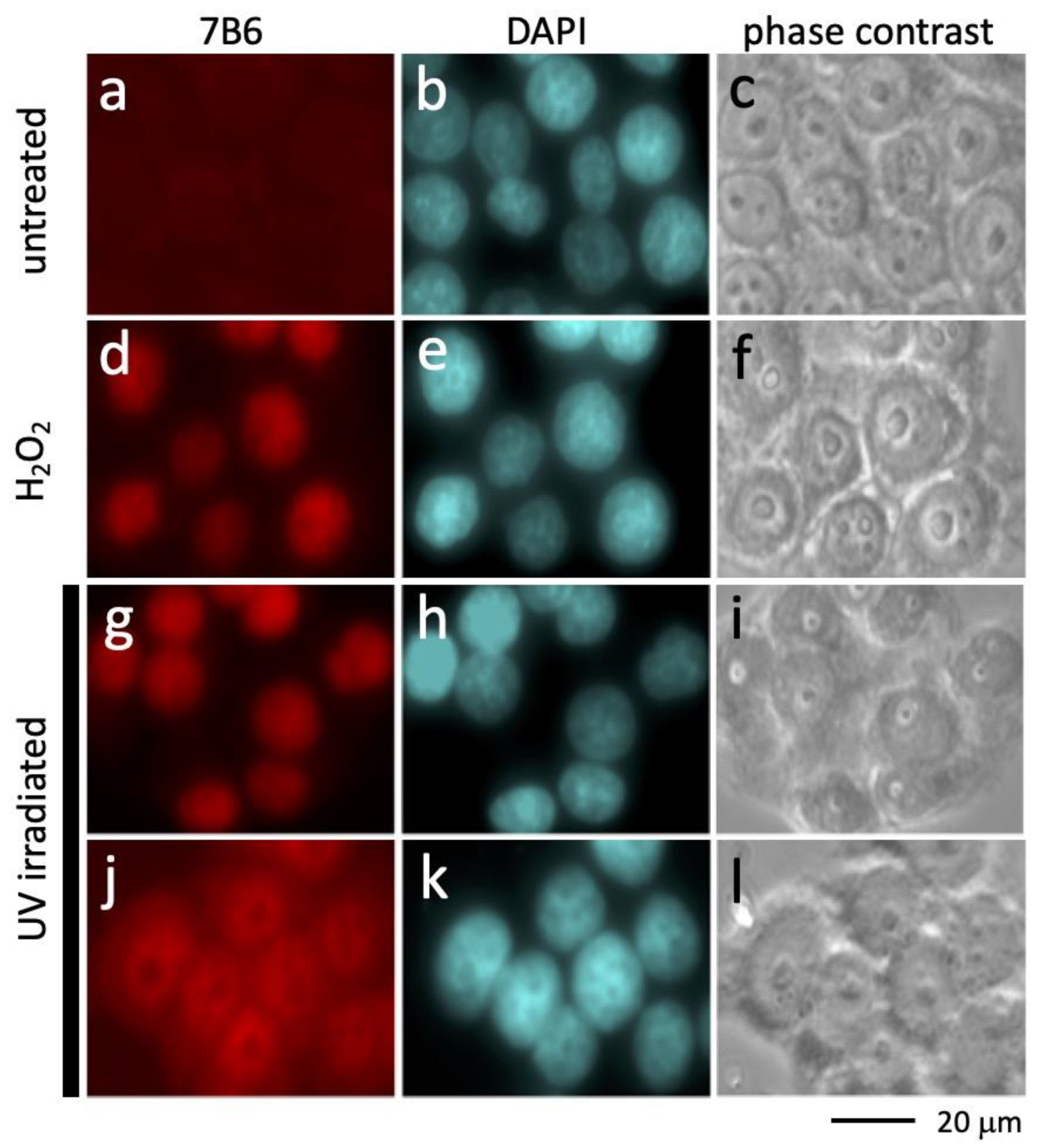 IJMS | Free Full-Text | And Yet It Moves: Oxidation of the Nuclear 