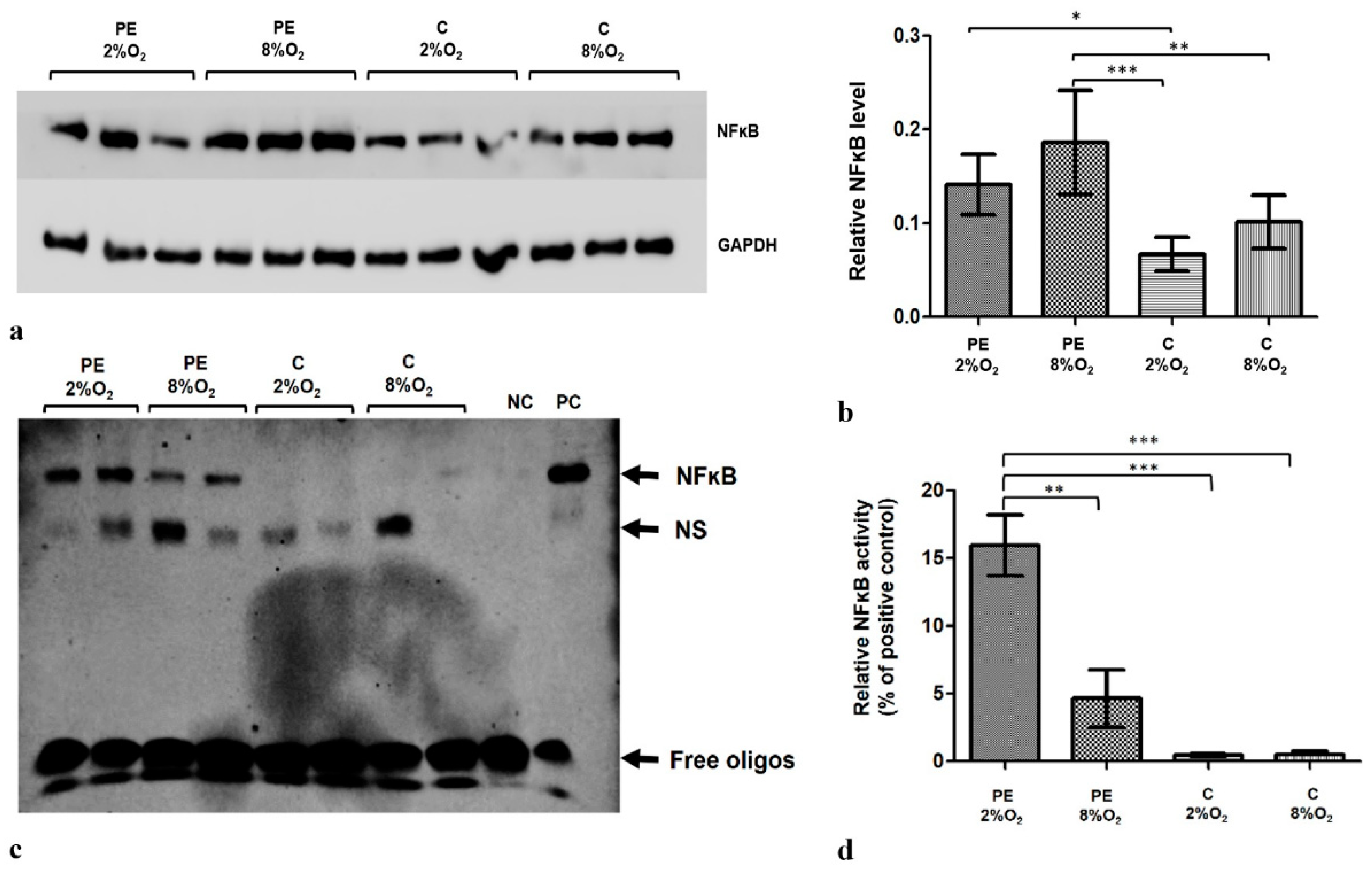 IJMS | Free Full-Text | The Preeclamptic Environment Promotes the  Activation of Transcription Factor Kappa B by P53/RSK1 Complex in a  HTR8/SVneo Trophoblastic Cell Line