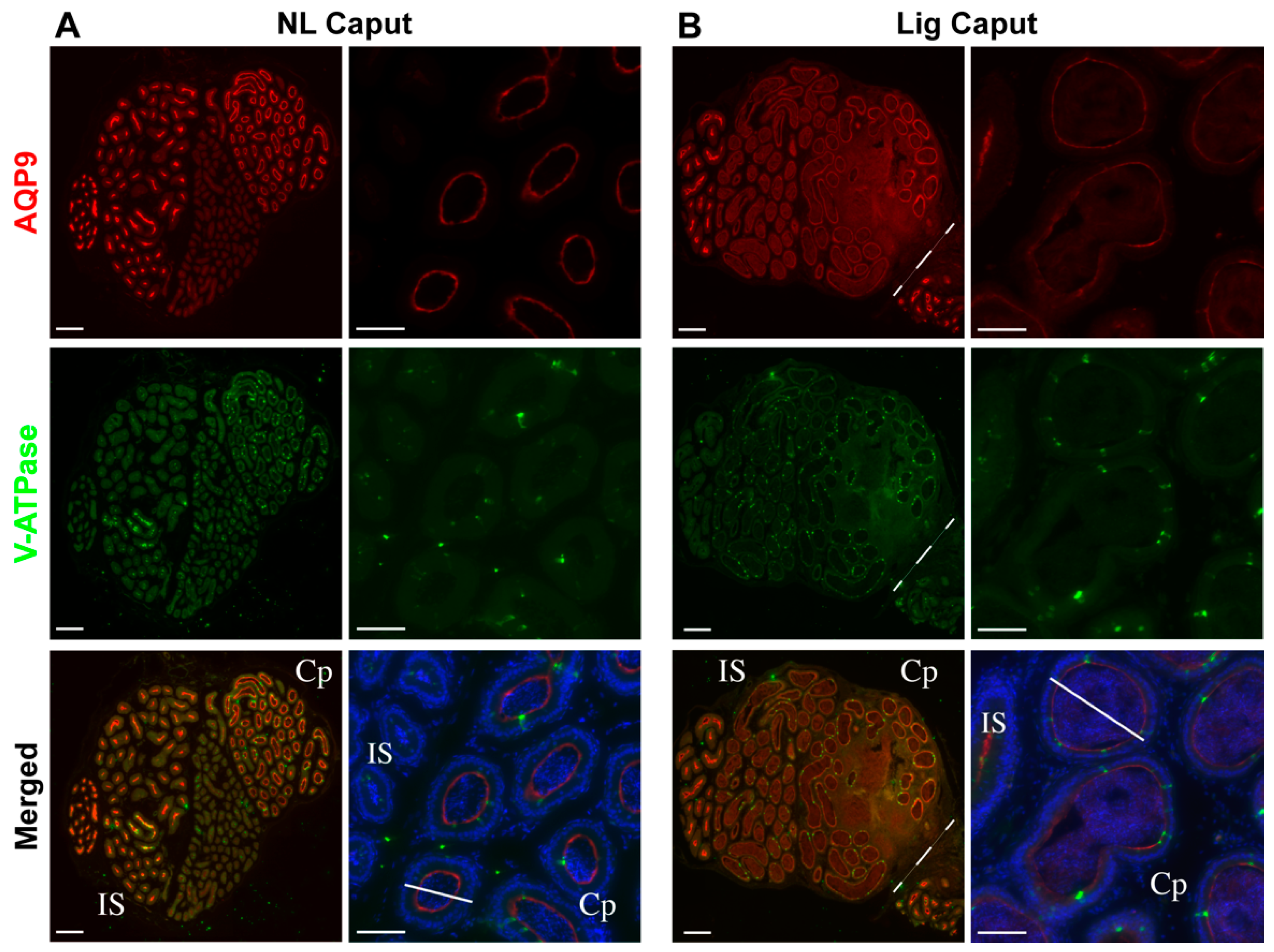 IJMS | Free Full-Text | Caput Ligation Renders Immature Mouse Sperm ...