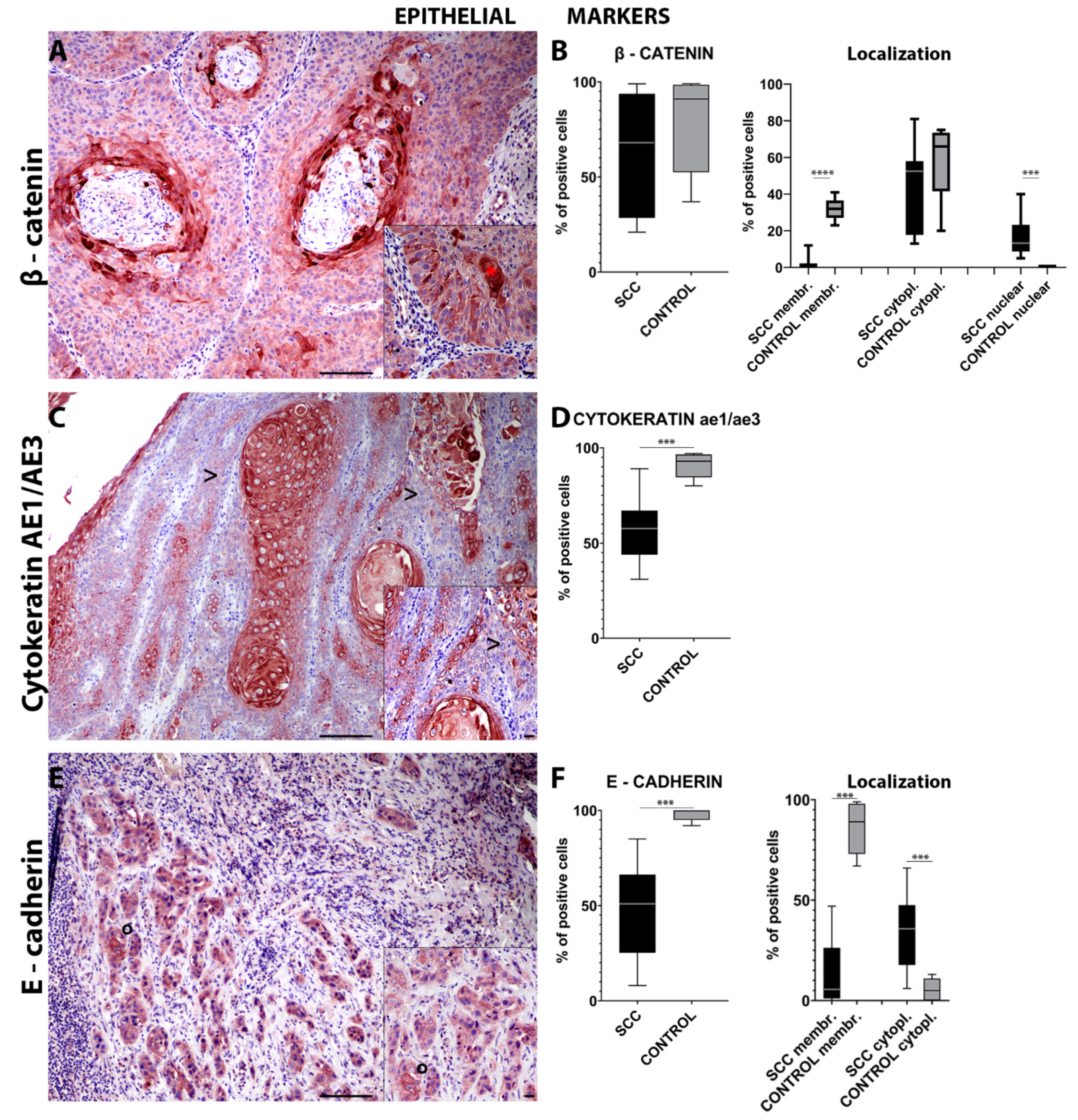 IJMS | Free Full-Text | Investigation of the Epithelial to Mesenchymal  Transition (EMT) Process in Equine Papillomavirus-2 (EcPV-2)-Positive Penile  Squamous Cell Carcinomas | HTML