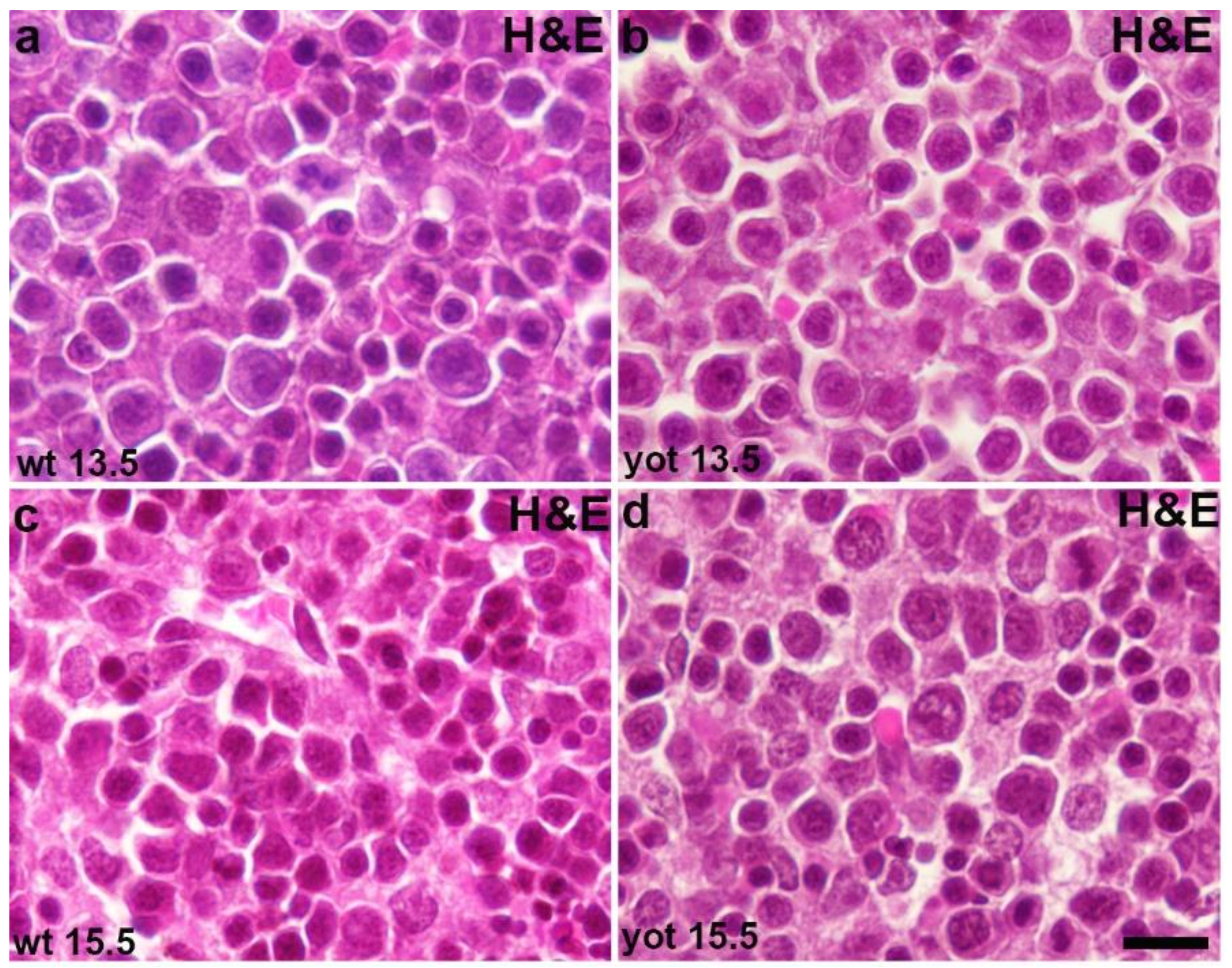 IJMS | Free Full-Text | Connexin Expression Is Altered in Liver