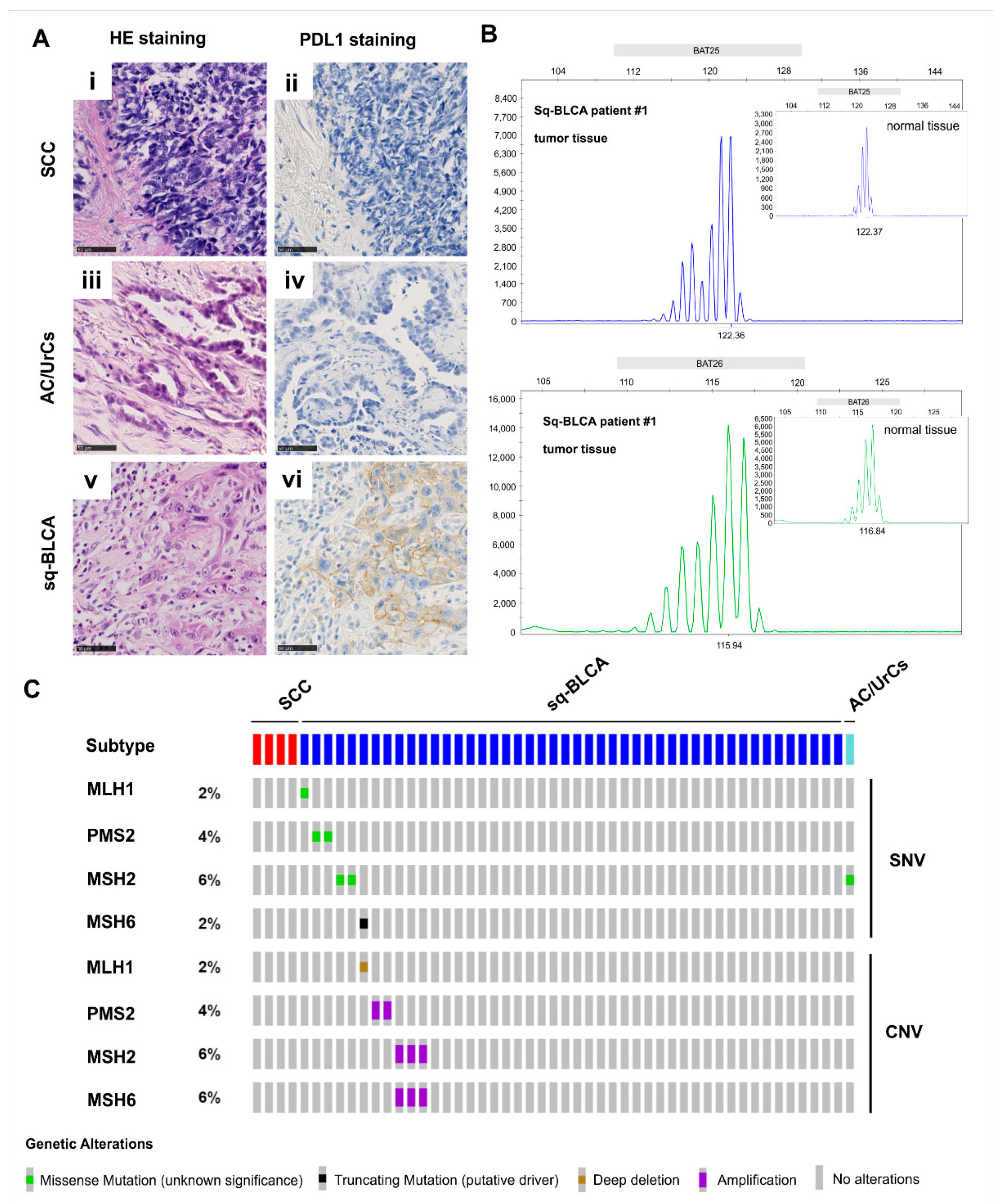 IJMS | Free Full-Text | Evaluation of Therapeutic Targets in Histological  Subtypes of Bladder Cancer