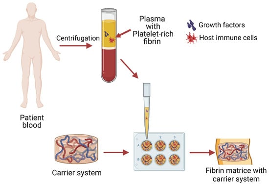 IJMS | Free Full-Text | From Blood to Regenerative Tissue: How ...