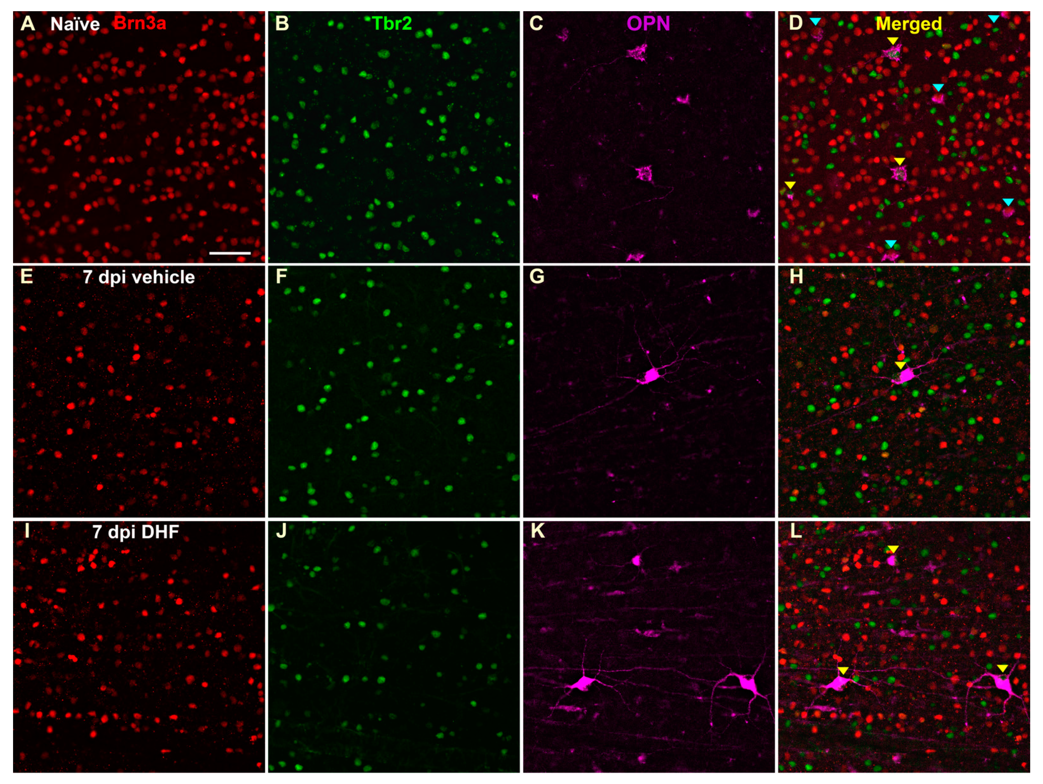 Ijms 22 11815 g005 Ijms 22 11815 g005