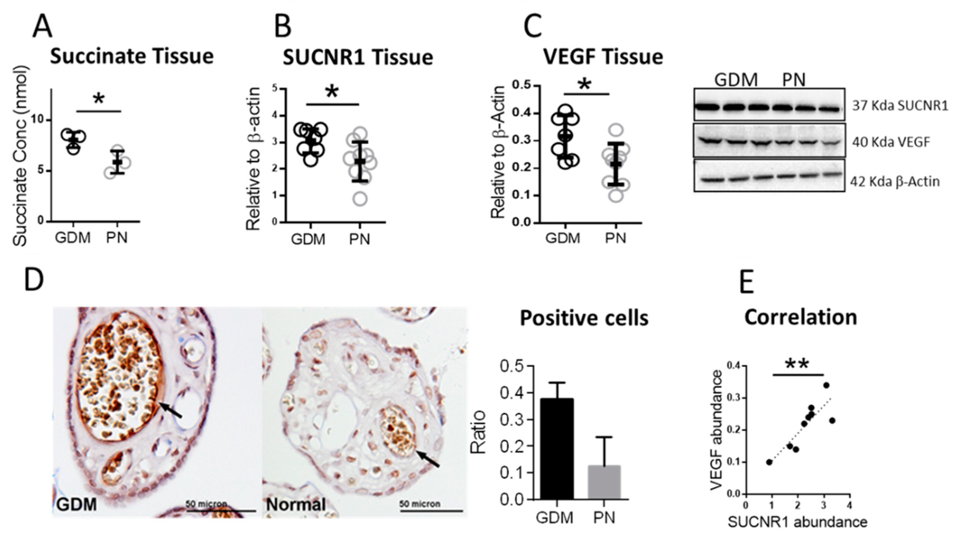 IJMS | Free Full-Text | SUCNR1 Is Expressed in Human Placenta and Mediates  Angiogenesis: Significance in Gestational Diabetes