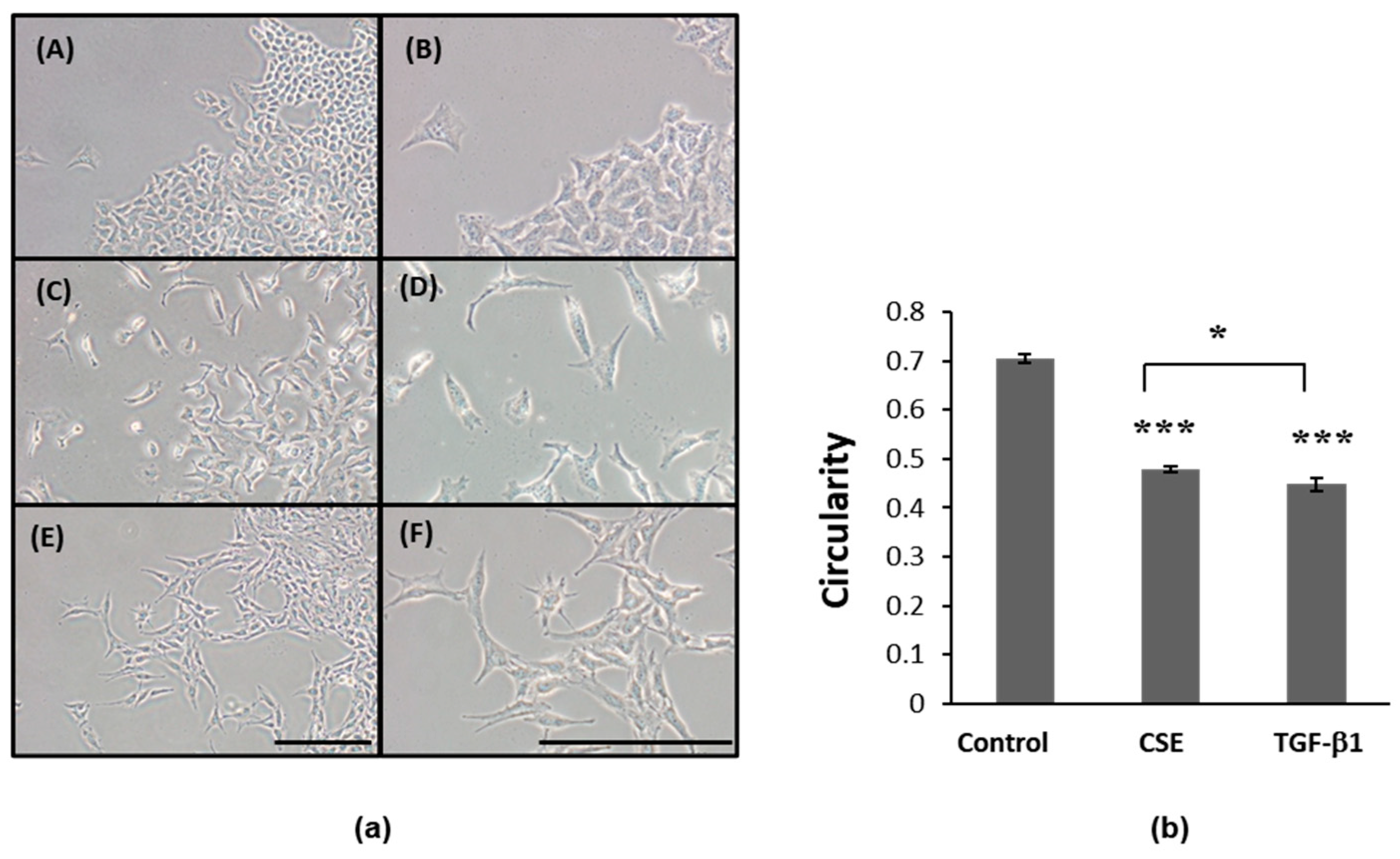 IJMS | Free Full-Text | Conditioned Media of Adipose-Derived Stem Cells ...