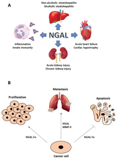 IJMS Free Full Text NGAL as a Potential Target in Tumor