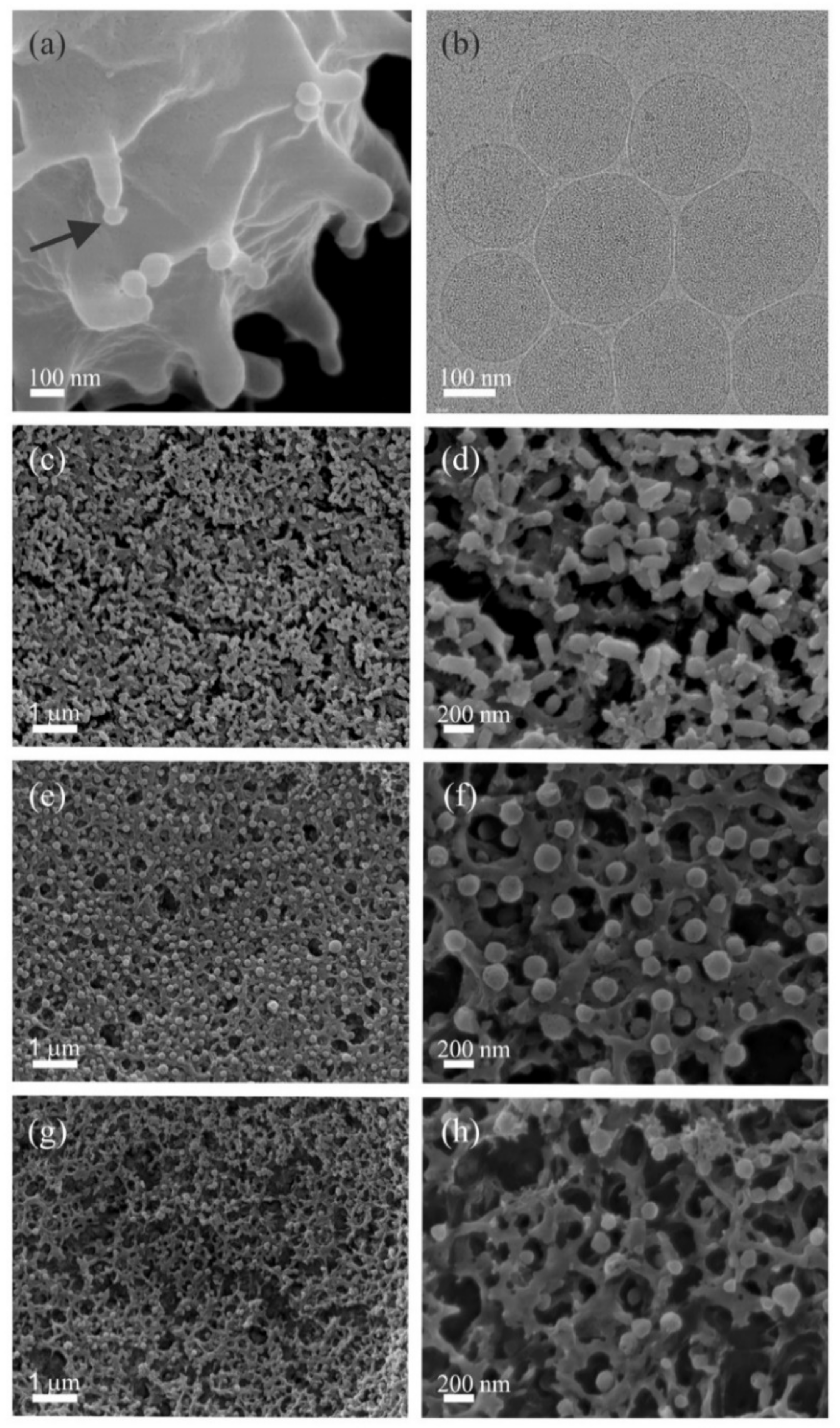 IJMS | Free Full-Text | Stability of Erythrocyte-Derived Nanovesicles  Assessed by Light Scattering and Electron Microscopy