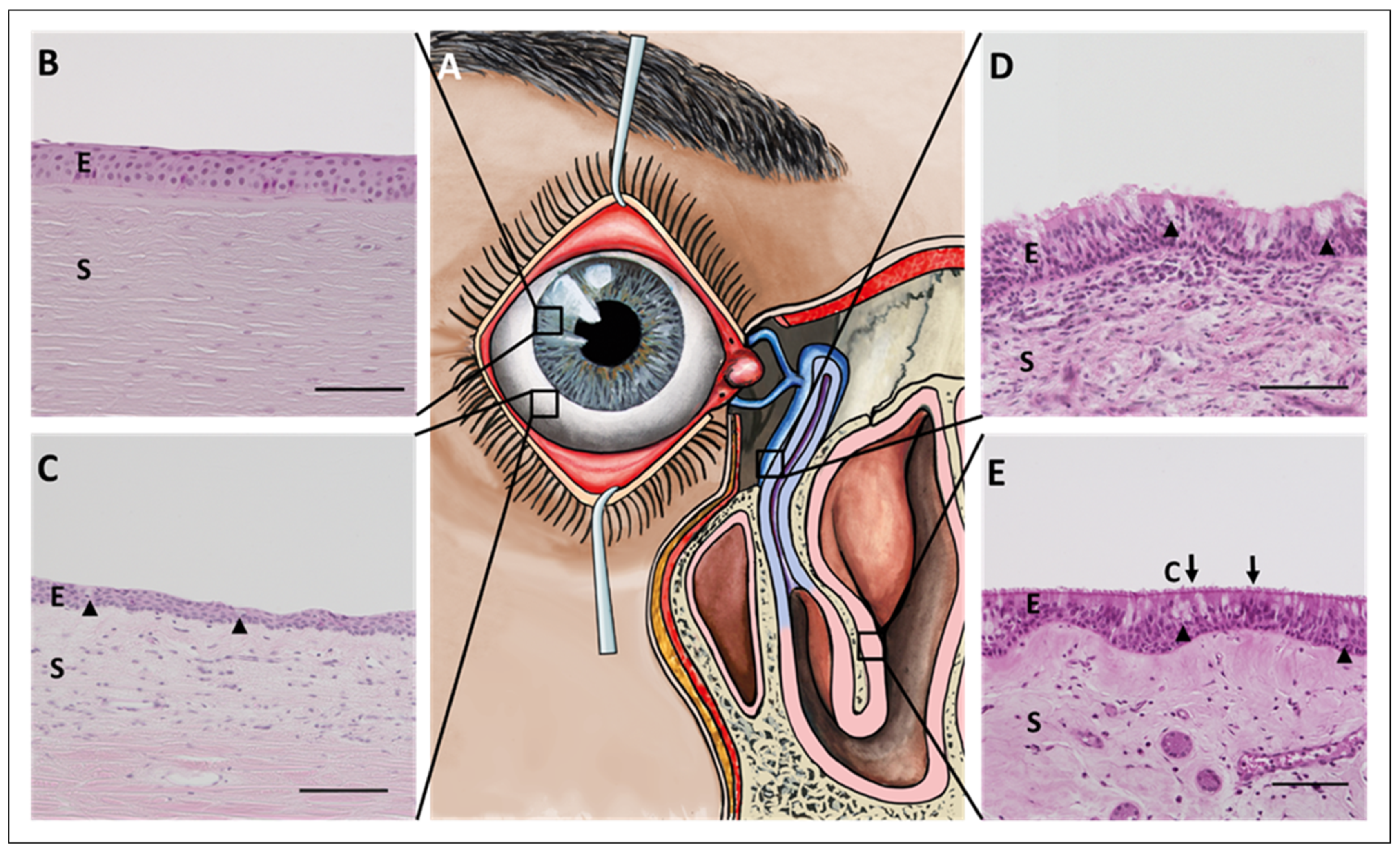 IJMS | Free Full-Text | The Communication between Ocular Surface and Nasal  Epithelia in 3D Cell Culture Technology for Translational Research: A  Narrative Review | HTML