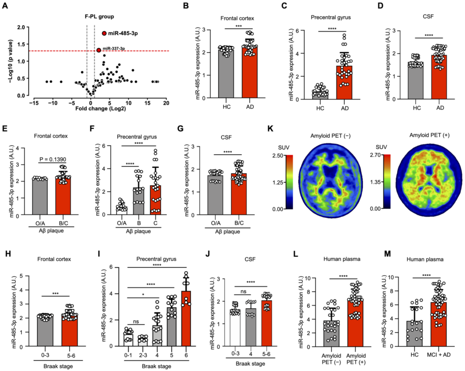 IJMS | Free Full-Text | Targeting MicroRNA-485-3p Blocks Alzheimer's  Disease Progression