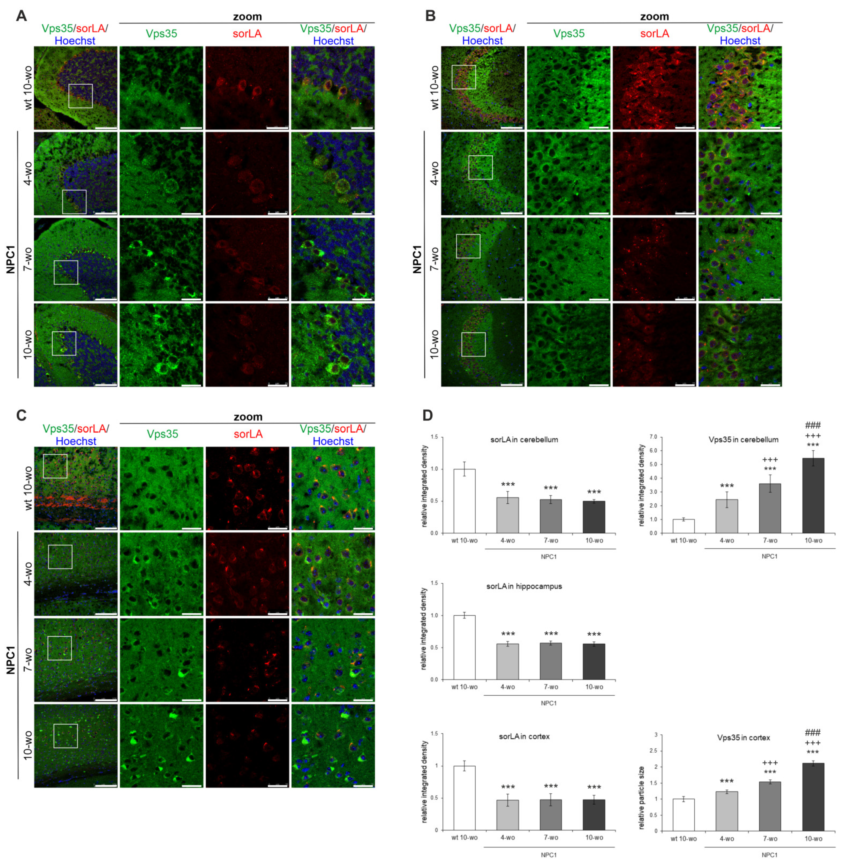 Ijms 22 13256 g004 Ijms 22 13256 g004