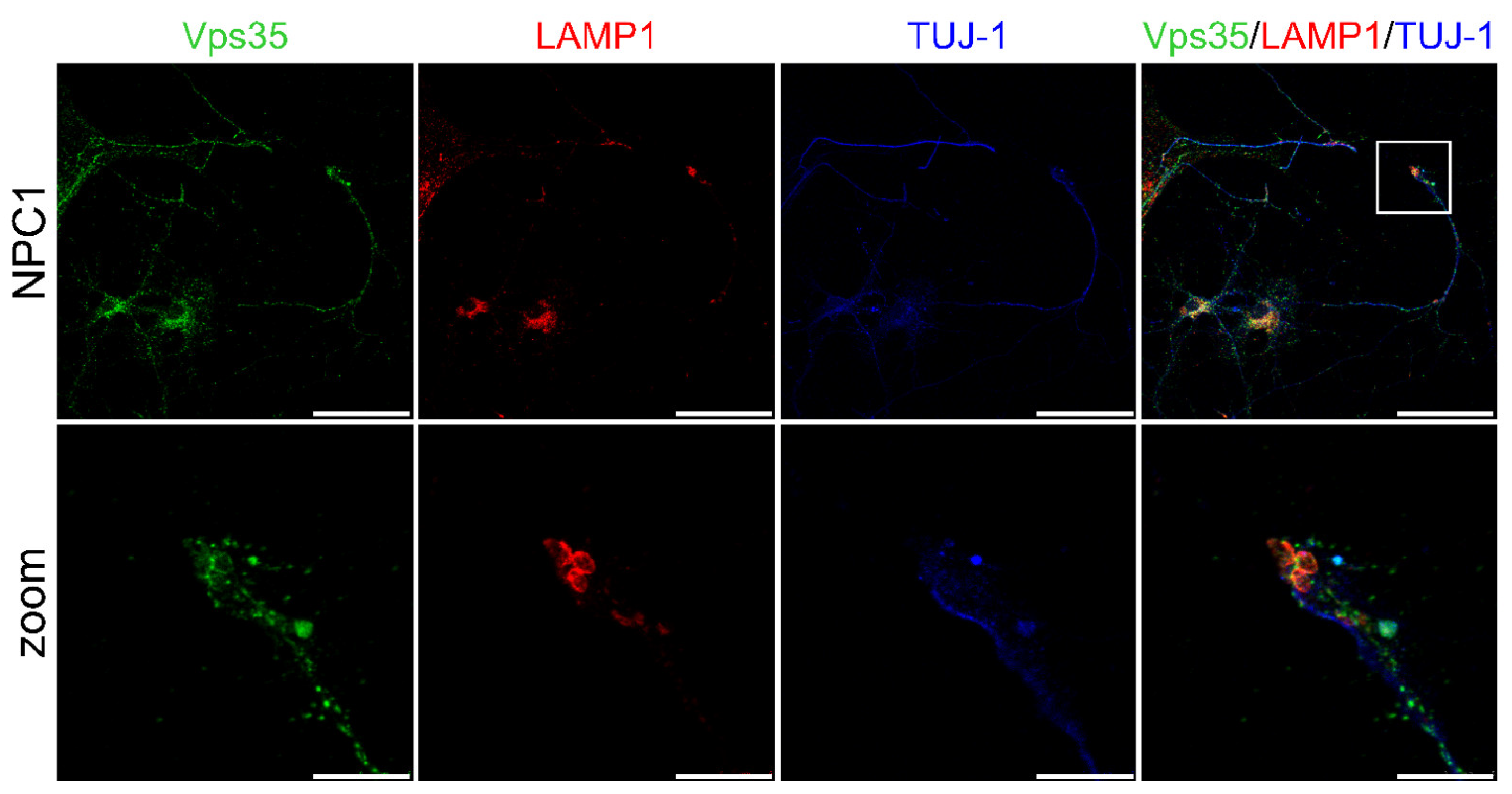 Ijms 22 13256 g007 Ijms 22 13256 g007