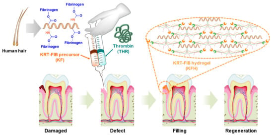 IJMS | Free Full-Text | Injectable Human Hair Keratin–Fibrinogen ...