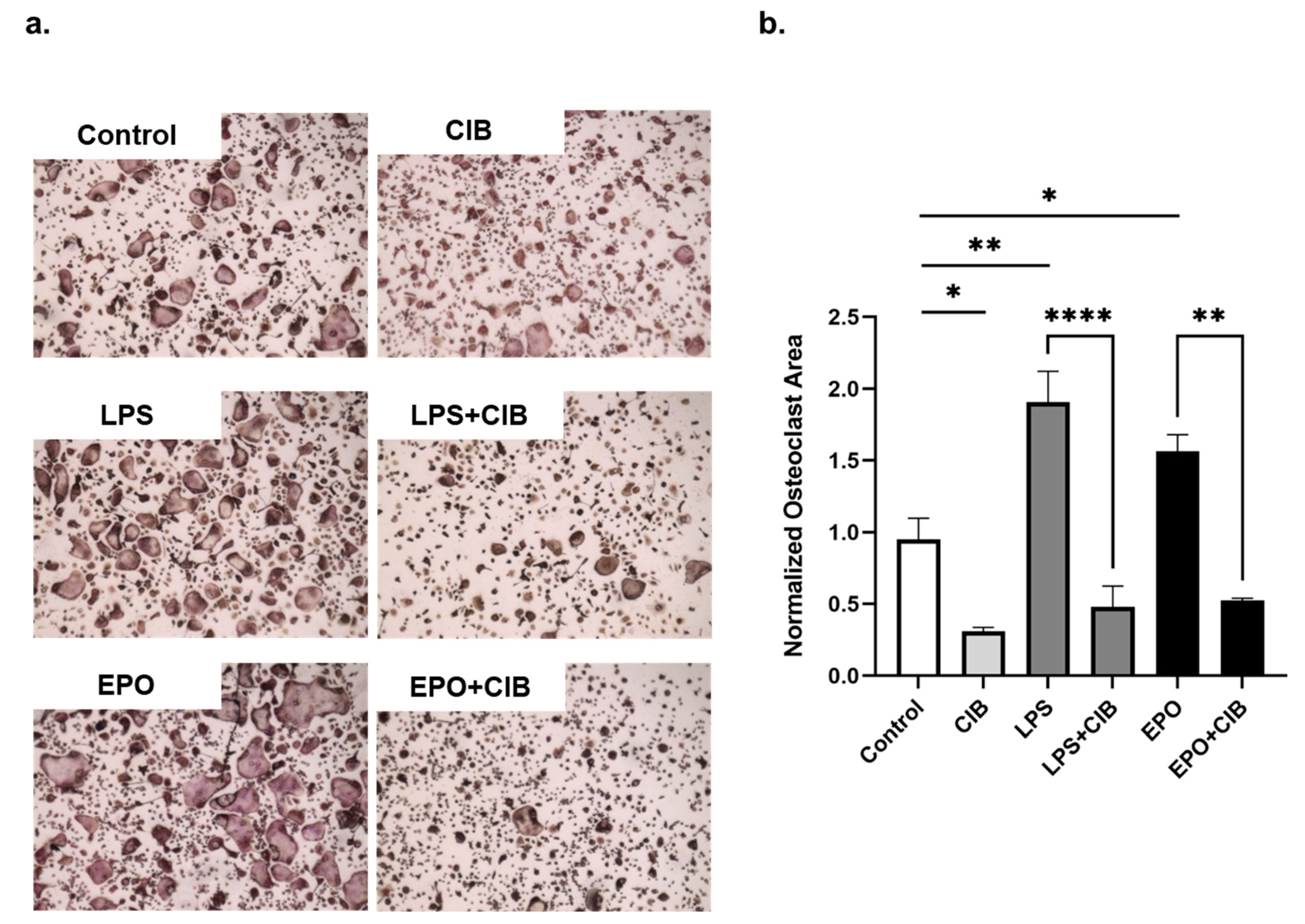 IJMS | Free Full-Text | The Non-Erythropoietic EPO Analogue Cibinetide  Inhibits Osteoclastogenesis In Vitro and Increases Bone Mineral Density in  Mice