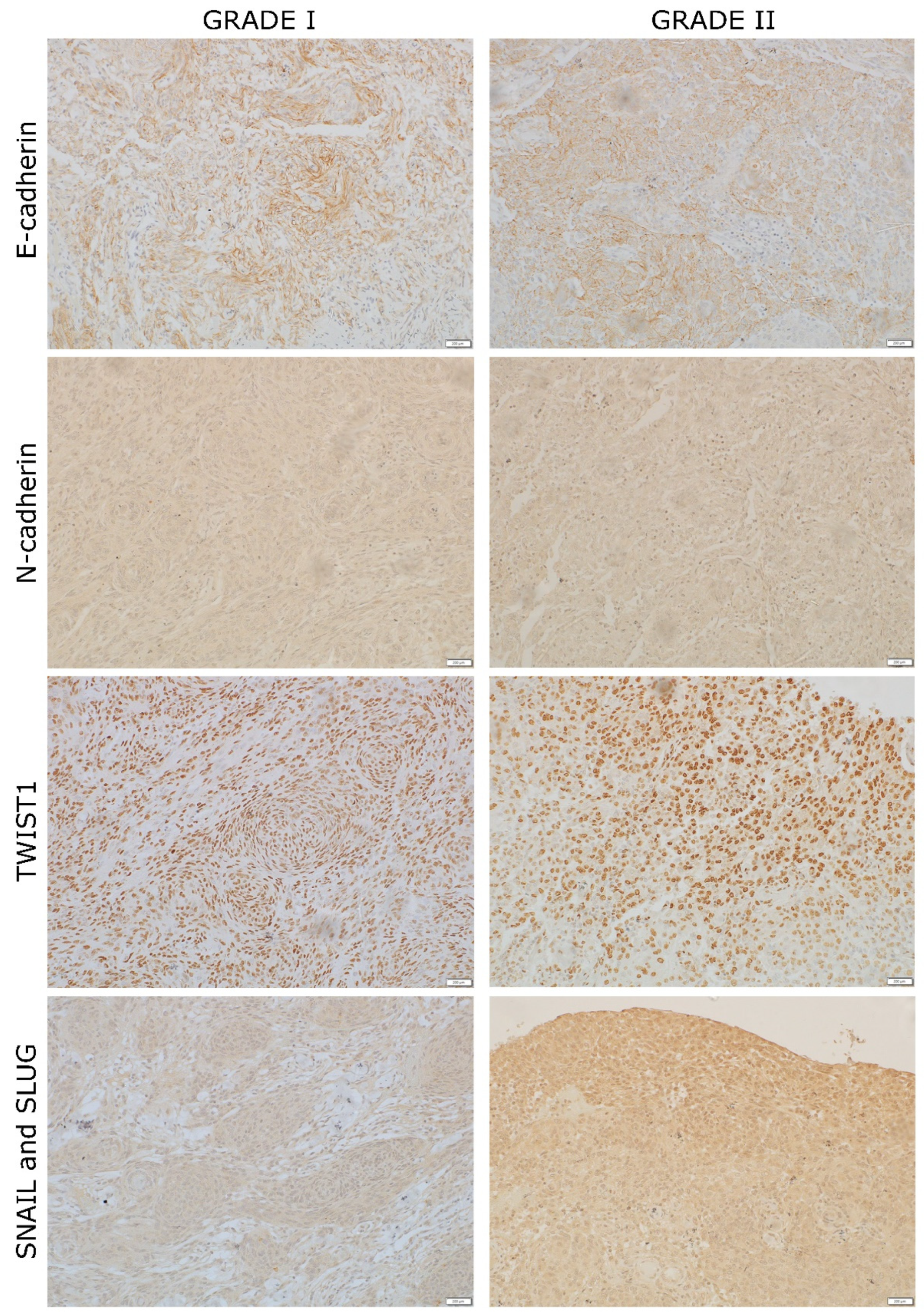 Ijms 23 01187 g002