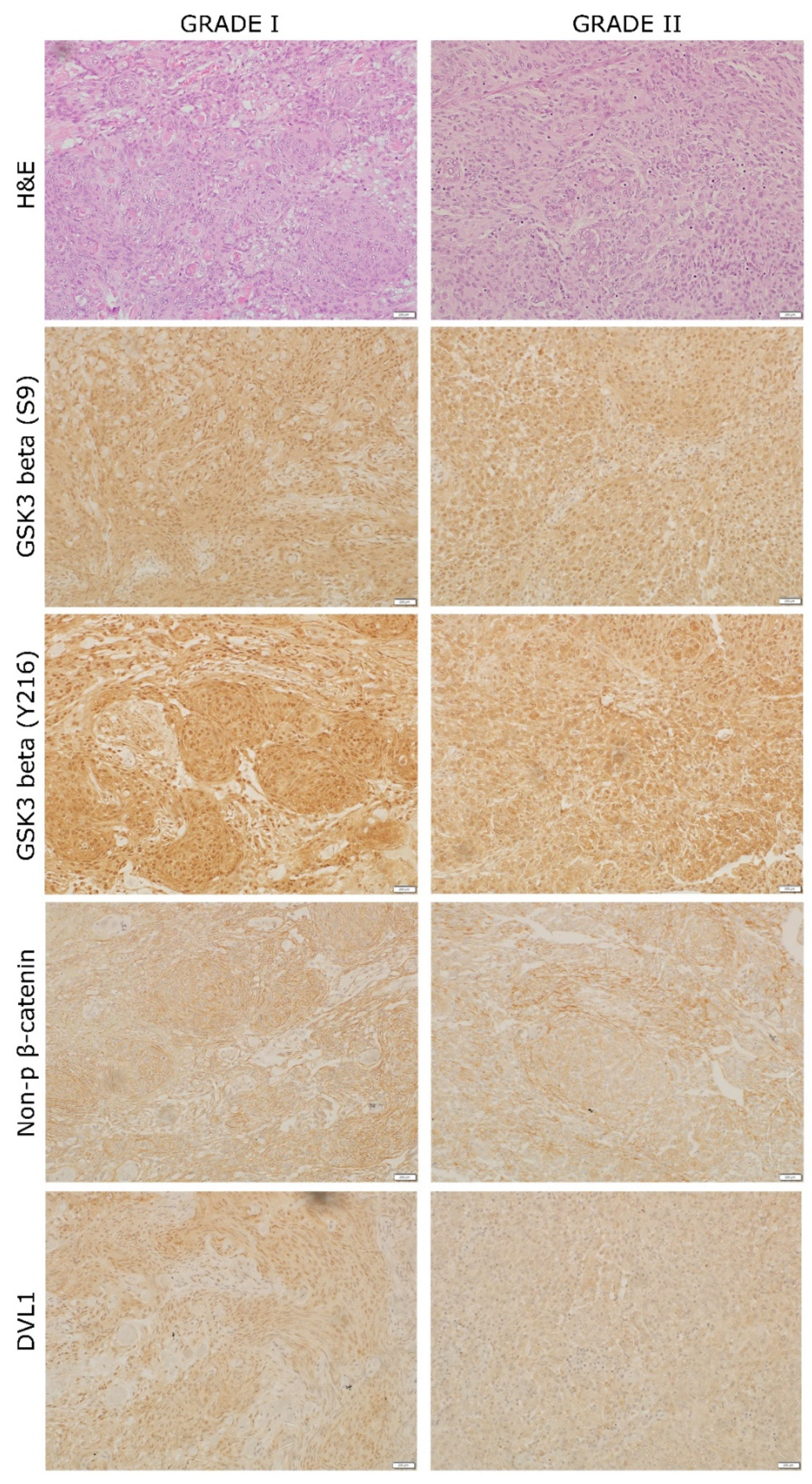 Ijms 23 01187 g003