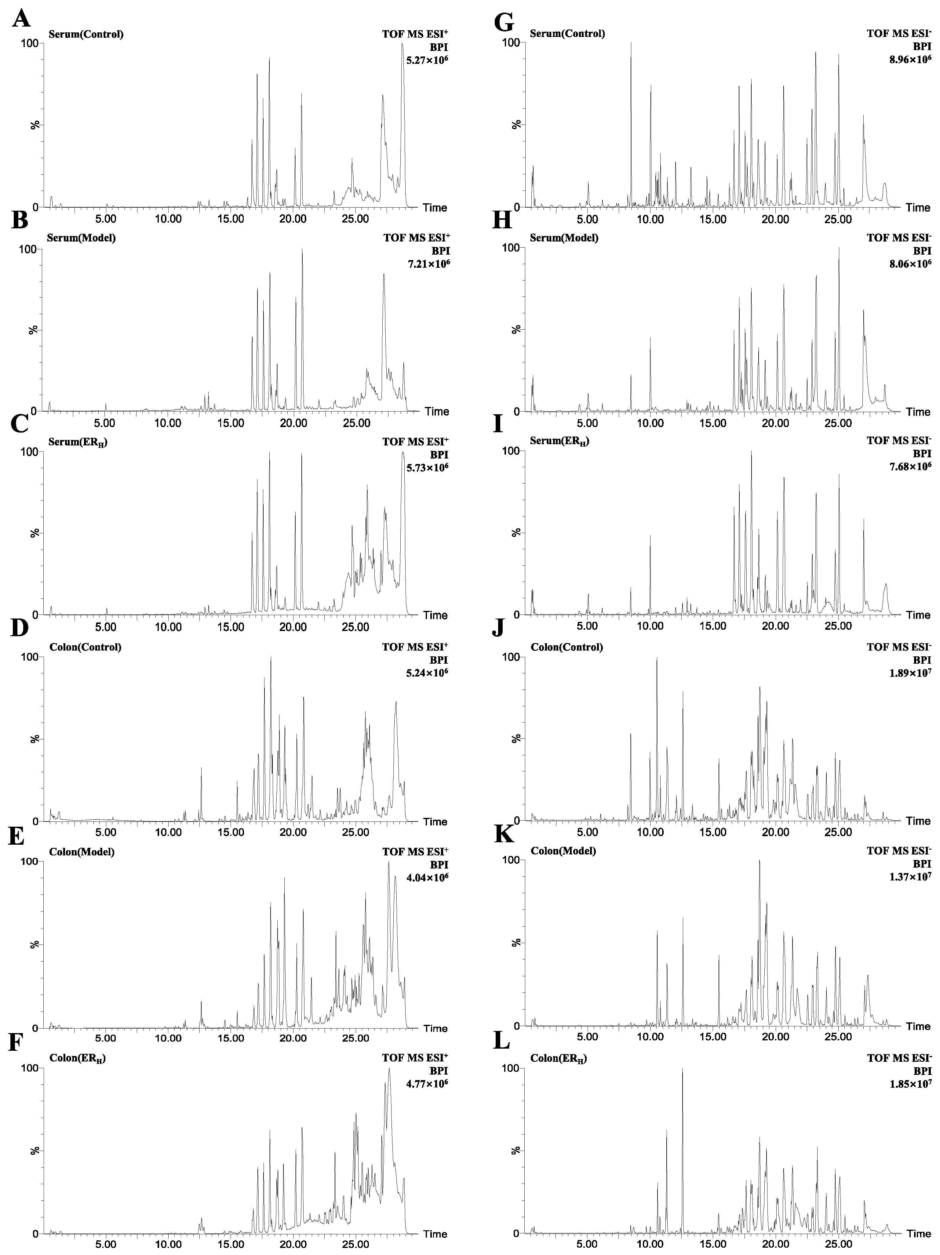 Typical BPI of feces samples in positive ESI mode. (A) Control group;