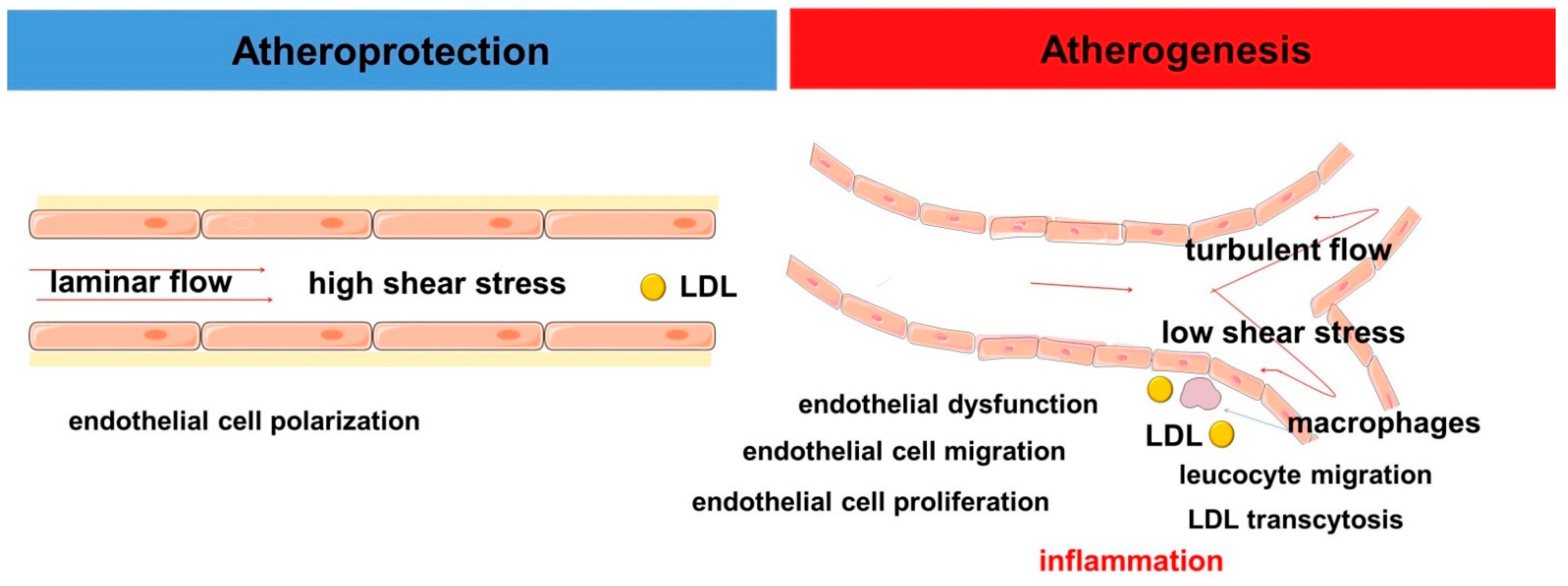 IJMS | Free Full-Text | Involvement of Fatty Acids and Their Metabolites in  the Development of Inflammation in Atherosclerosis