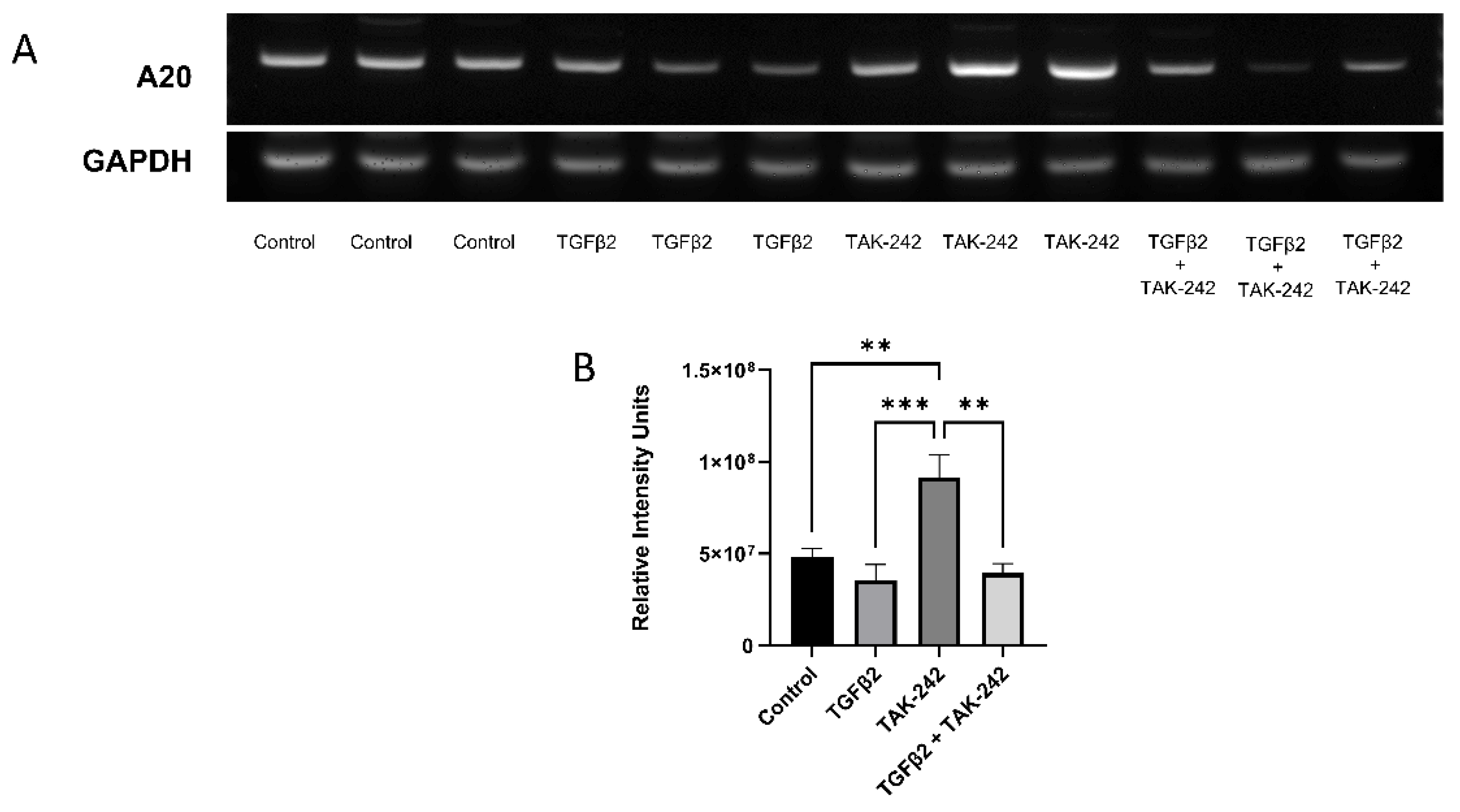 IJMS | Free Full-Text | A20 Attenuates the Fibrotic Response in 