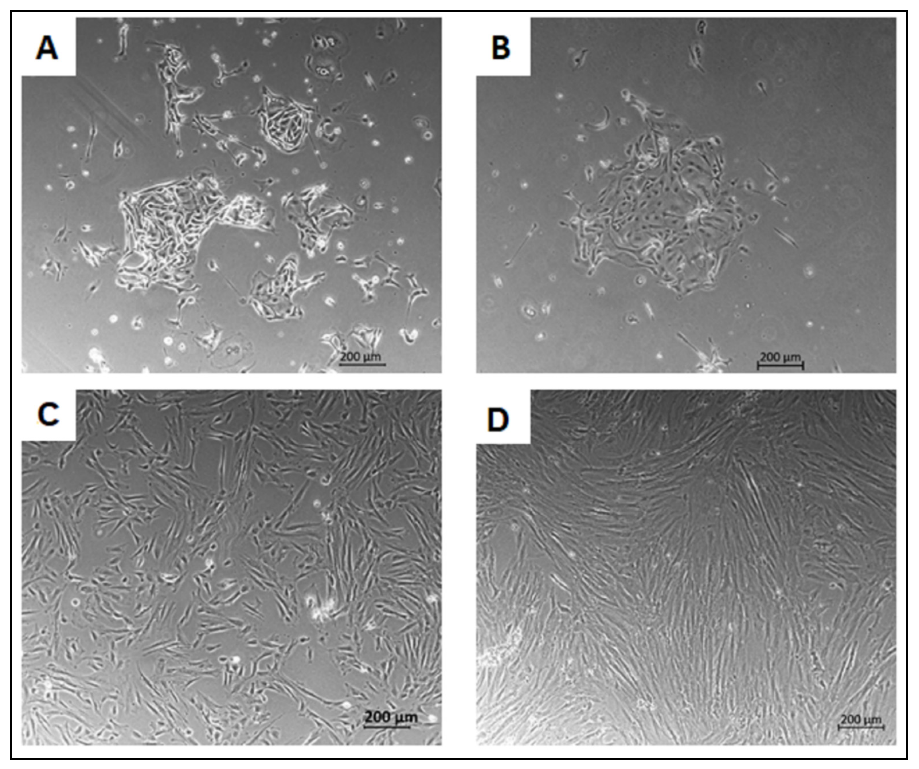 Transplantation of human endometrial perivascular cells with