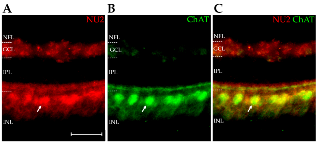 Ijms Free Full Text An Essential Role For Alzheimer Rsquo S Linked Amyloid Beta Oligomers In Neurodevelopment Transient Expression Of Multiple Proteoforms During Retina Histogenesis Html