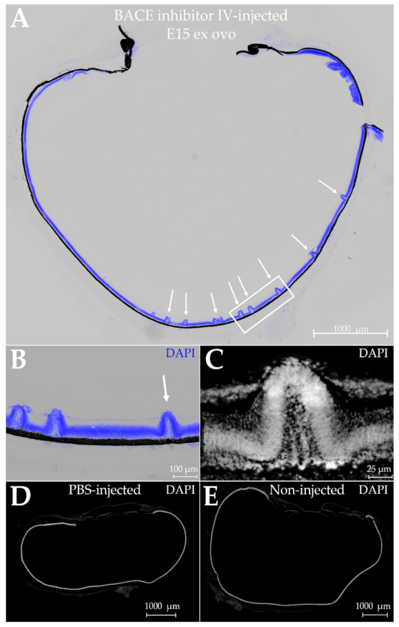 Ijms Free Full Text An Essential Role For Alzheimer Rsquo S Linked Amyloid Beta Oligomers In Neurodevelopment Transient Expression Of Multiple Proteoforms During Retina Histogenesis Html