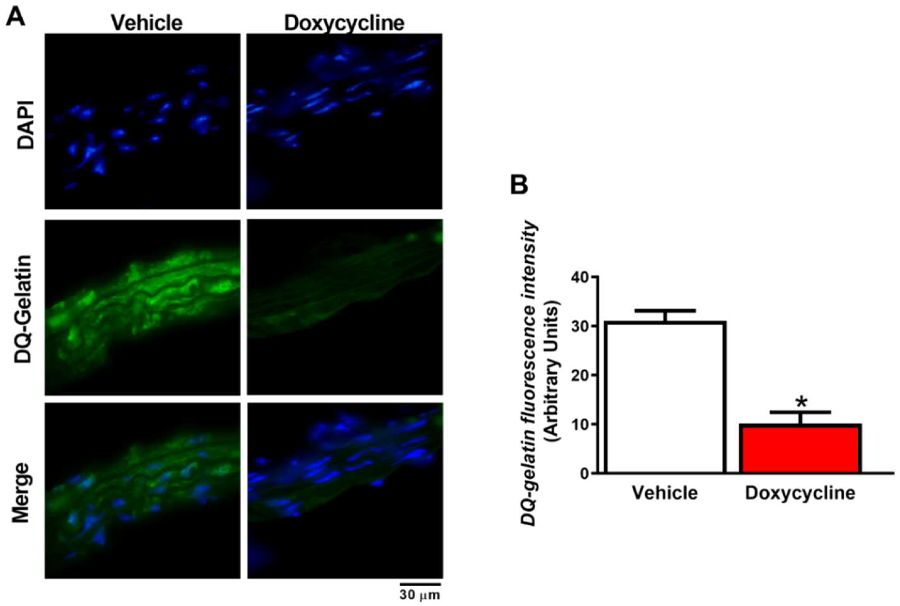 IJMS | Free Full-Text | Doxycycline Decreases Atherosclerotic Lesions in  the Aorta of ApoE-&frasl;- and Ovariectomized Mice with Correlation to  Reduced MMP-2 Activity