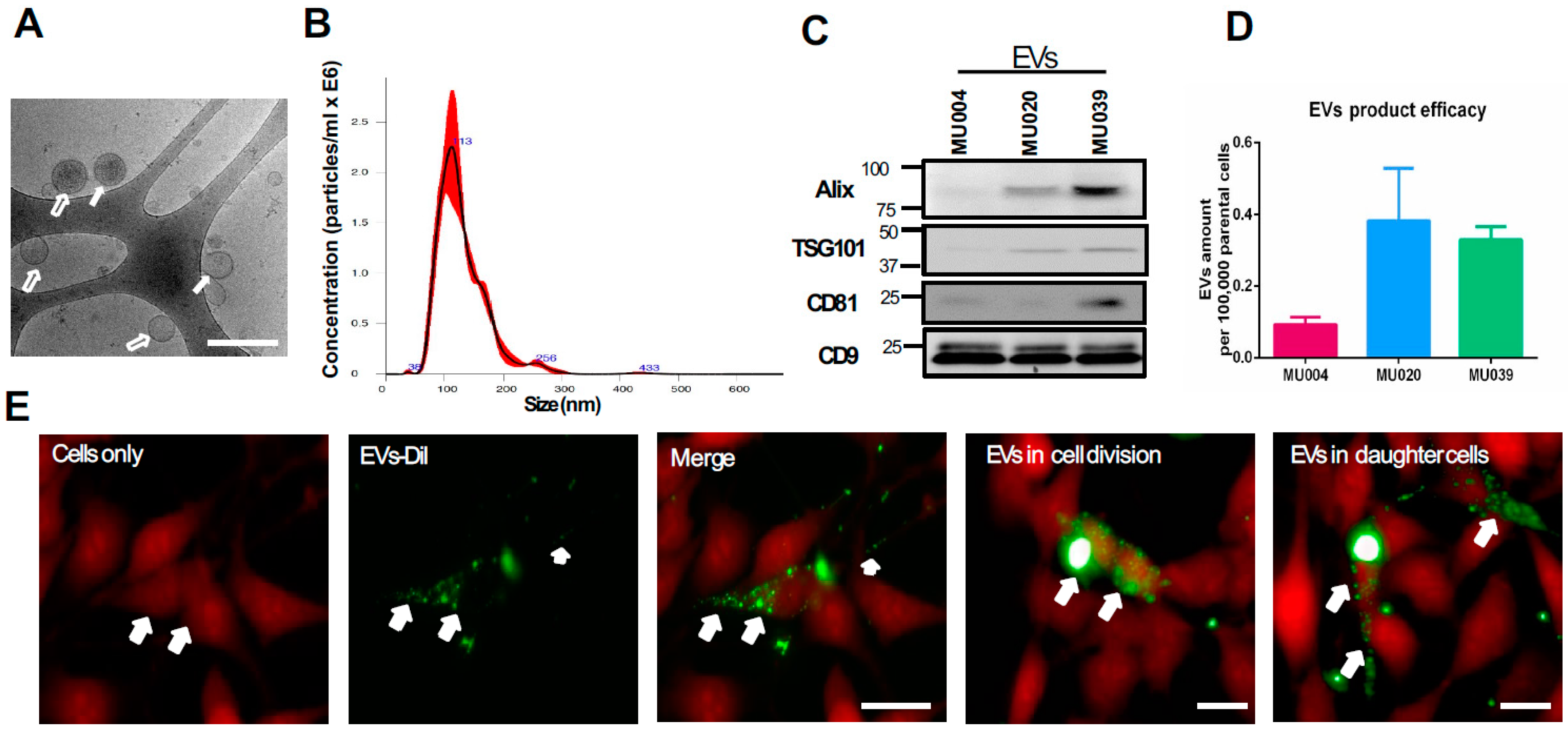 IJMS Free Full Text Extracellular Vesicles Secreted by Glioma