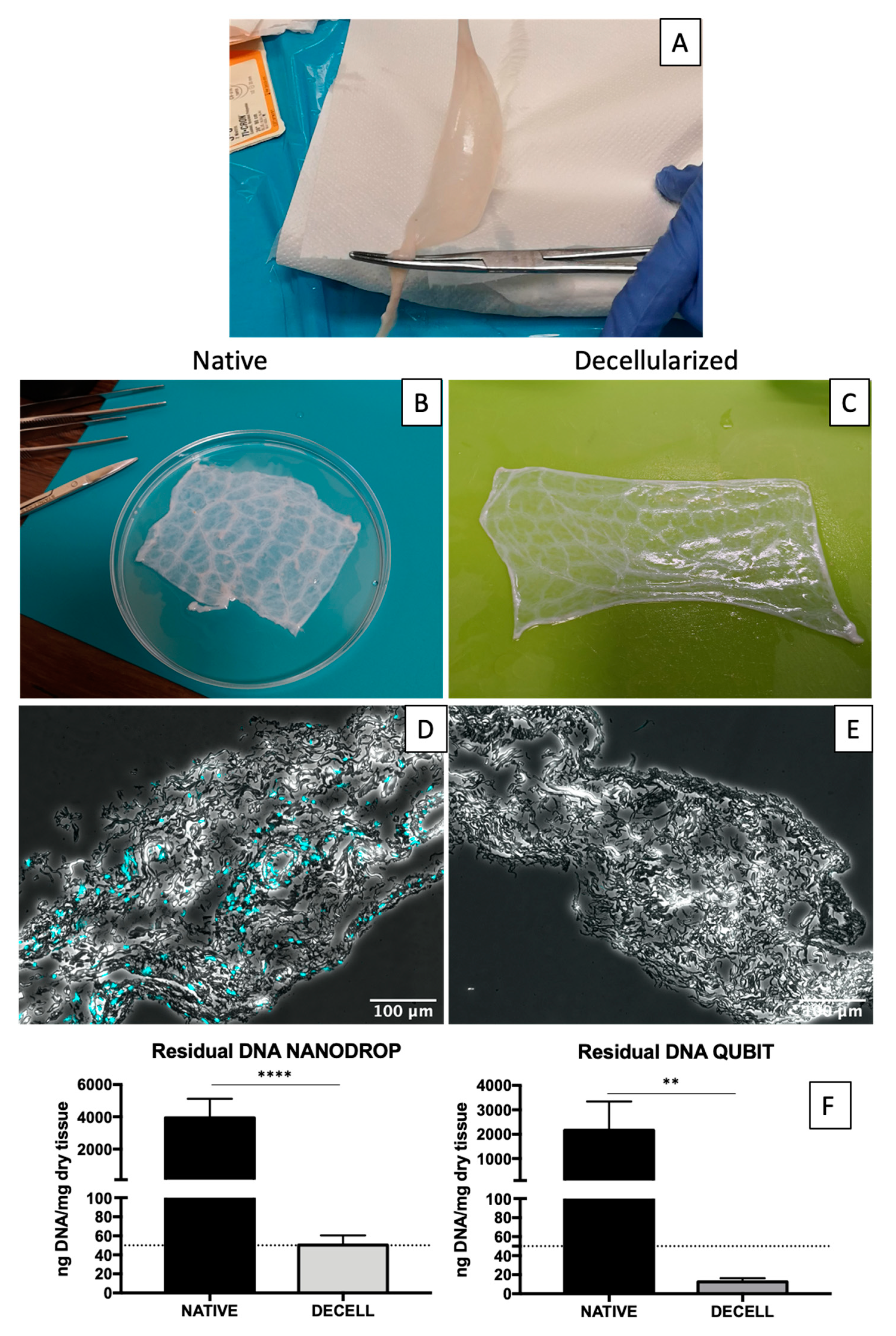 IJMS | Free Full-Text | Porcine Small Intestinal Submucosa (SIS) as a  Suitable Scaffold for the Creation of a Tissue-Engineered Urinary Conduit:  Decellularization, Biomechanical and Biocompatibility Characterization  Using New Approaches