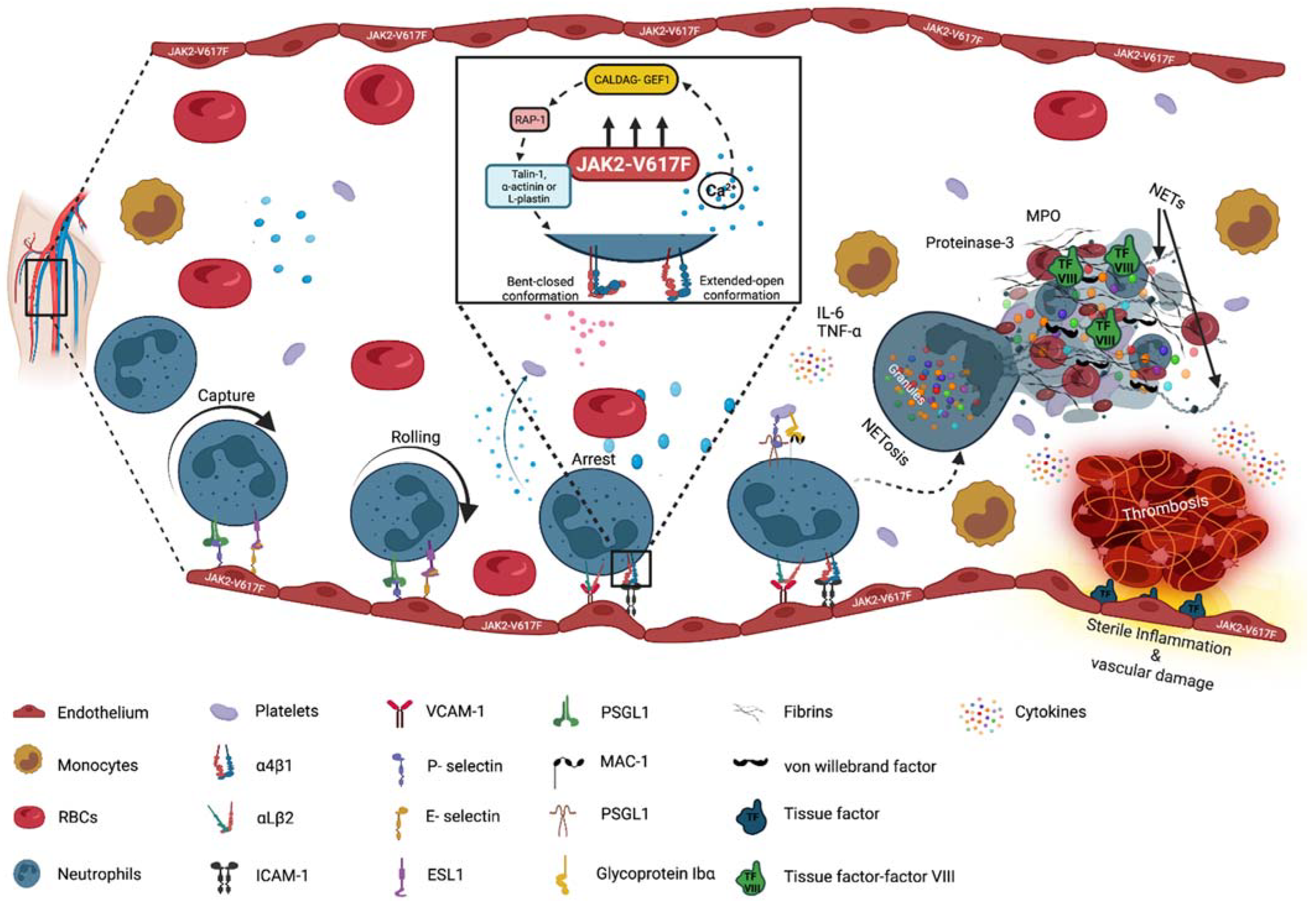 IJMS | Free Full-Text | Thromboinflammation in Myeloproliferative Neoplasms  (MPN)&mdash;A Puzzle Still to Be Solved
