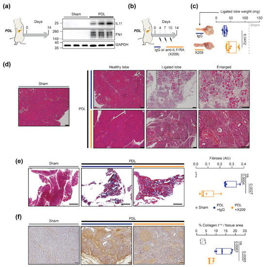 IJMS | Free Full-Text | IL11 Activates Pancreatic Stellate Cells and ...