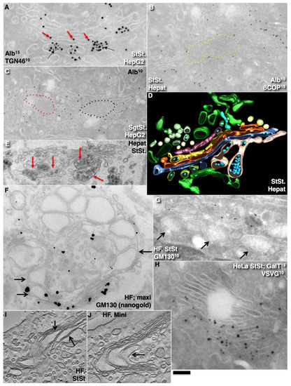 IJMS | Free Full-Text | Comparison of the Cisterna Maturation