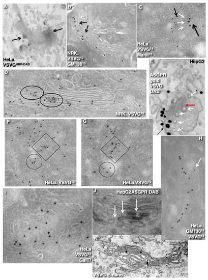 IJMS | Free Full-Text | Comparison of the Cisterna Maturation