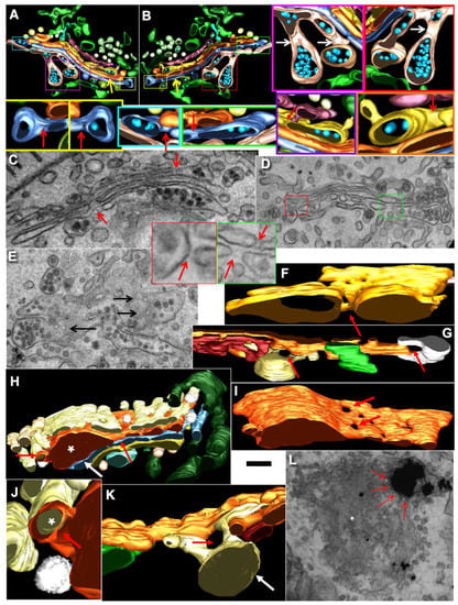 IJMS | Free Full-Text | Comparison of the Cisterna Maturation