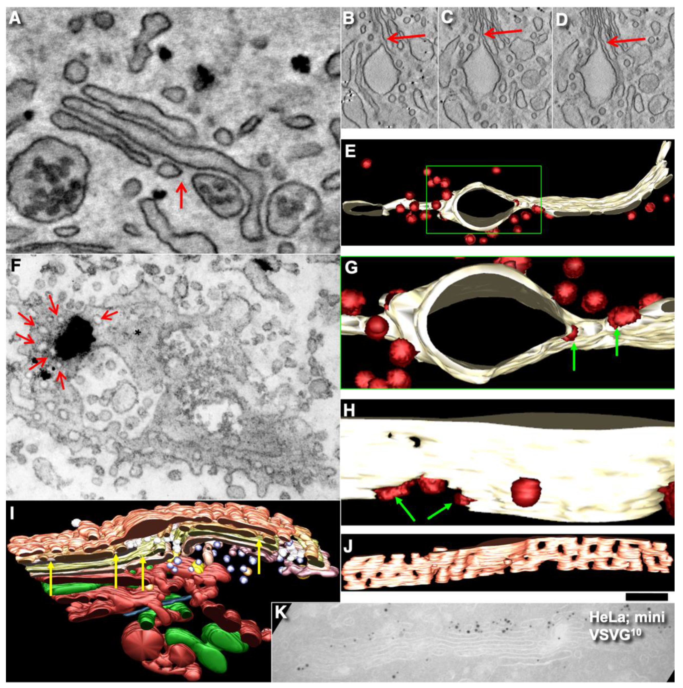 IJMS | Free Full-Text | Comparison of the Cisterna Maturation