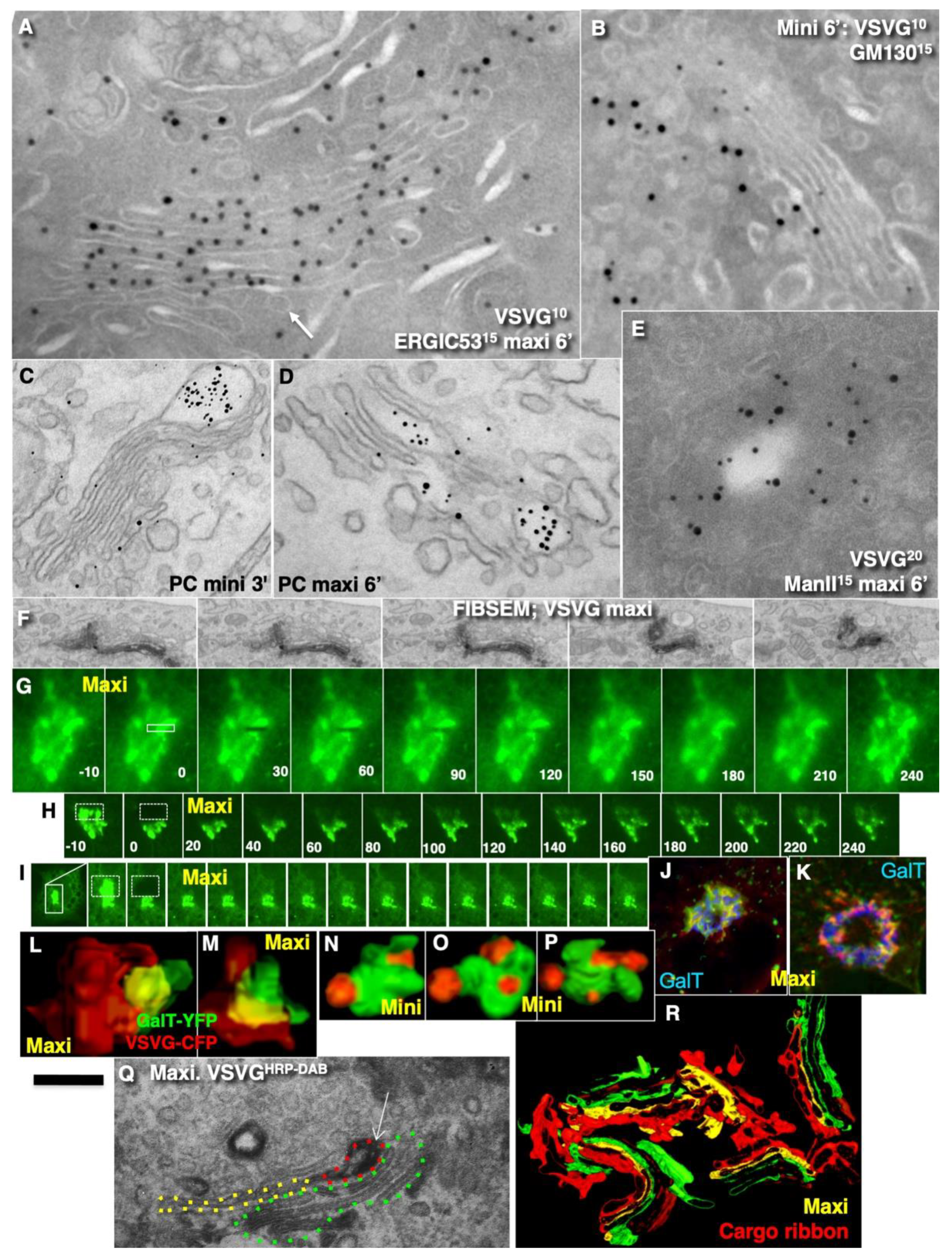 IJMS | Free Full-Text | Comparison of the Cisterna Maturation