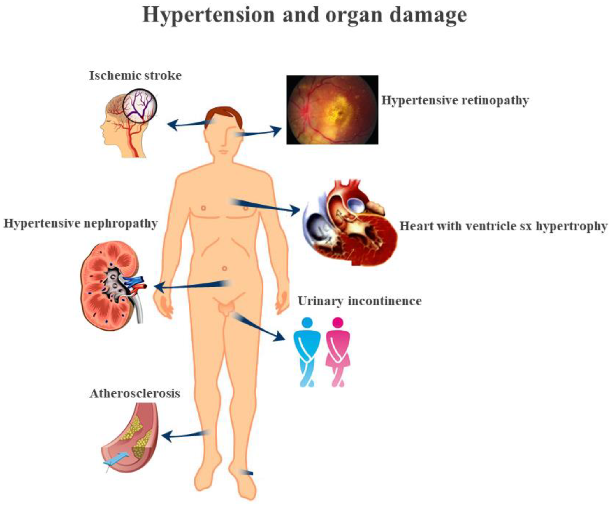 Hypertension and digestive health