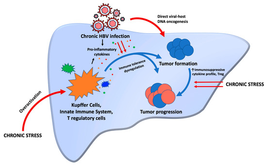 Hepatitis B Virus-associated Hepatocellular Carcinoma And Chronic Stress