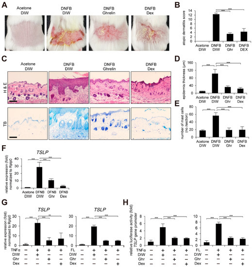IJMS | Free Full-Text | Ghrelin Represses Thymic Stromal Lymphopoietin Gene  Expression through Activation of Glucocorticoid Receptor and Protein Kinase  C Delta in Inflamed Skin Keratinocytes | HTML