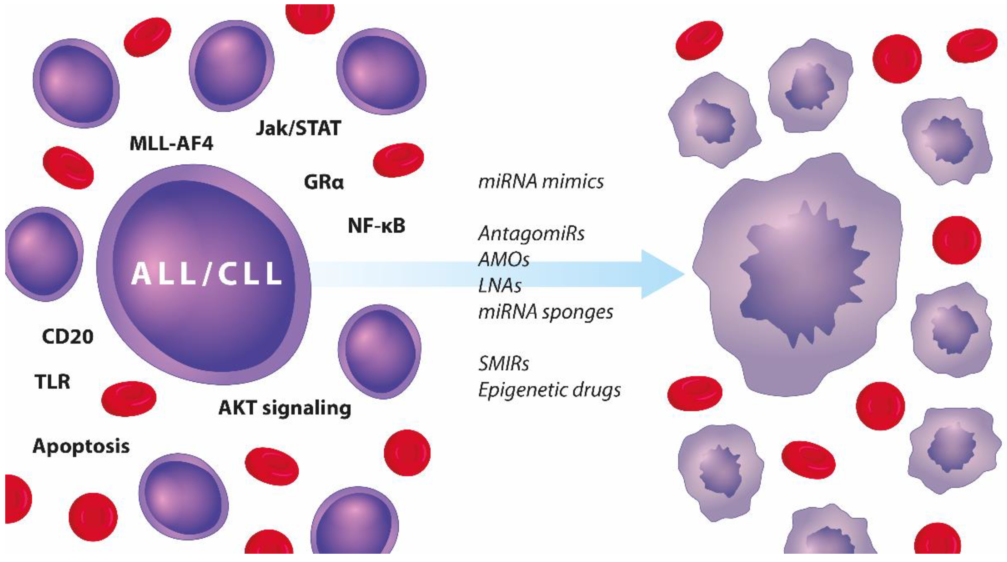 IJMS | Free Full-Text | miRNAs in Lymphocytic Leukaemias—The