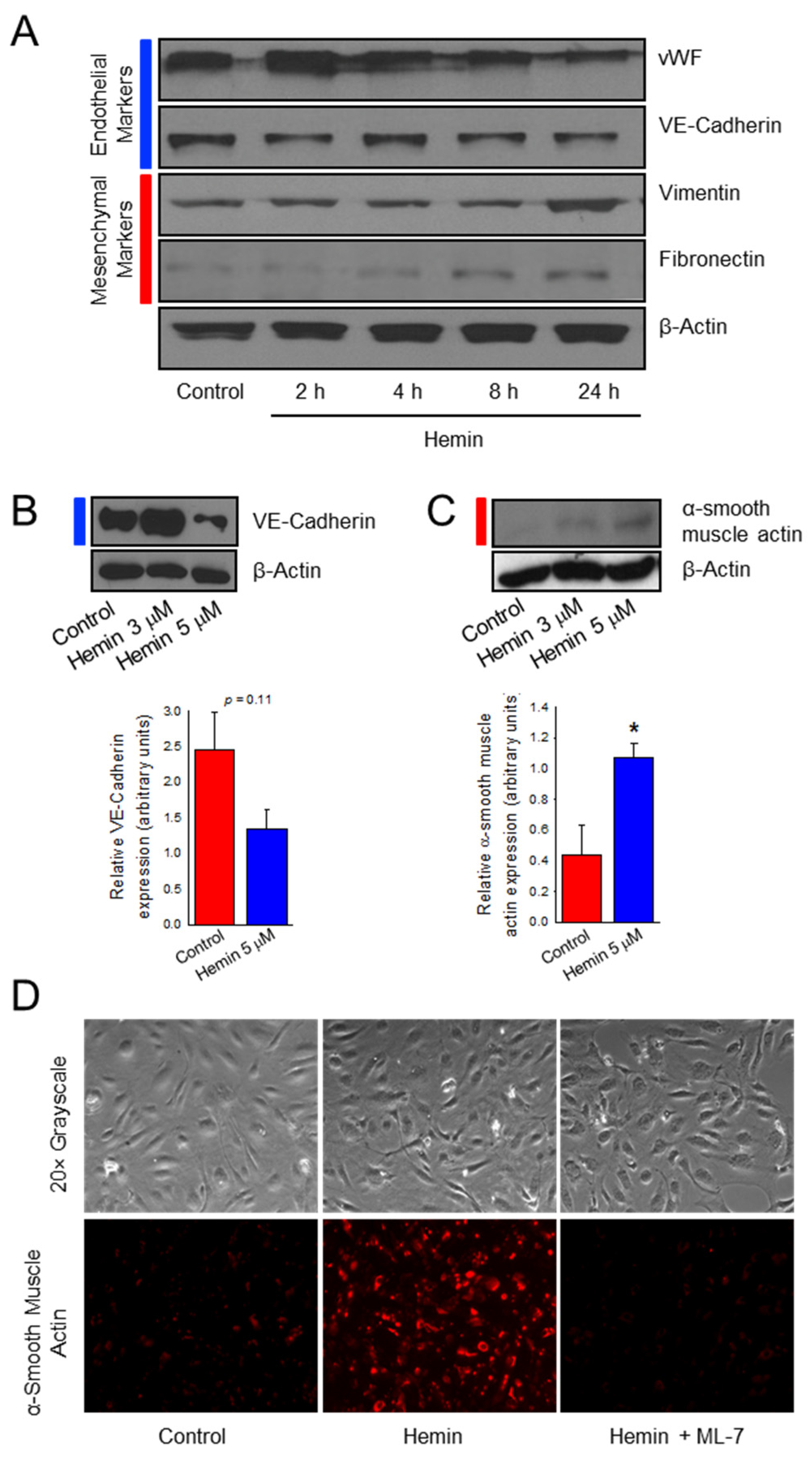 IJMS | Free Full-Text | Hemin-Induced Endothelial Dysfunction And ...