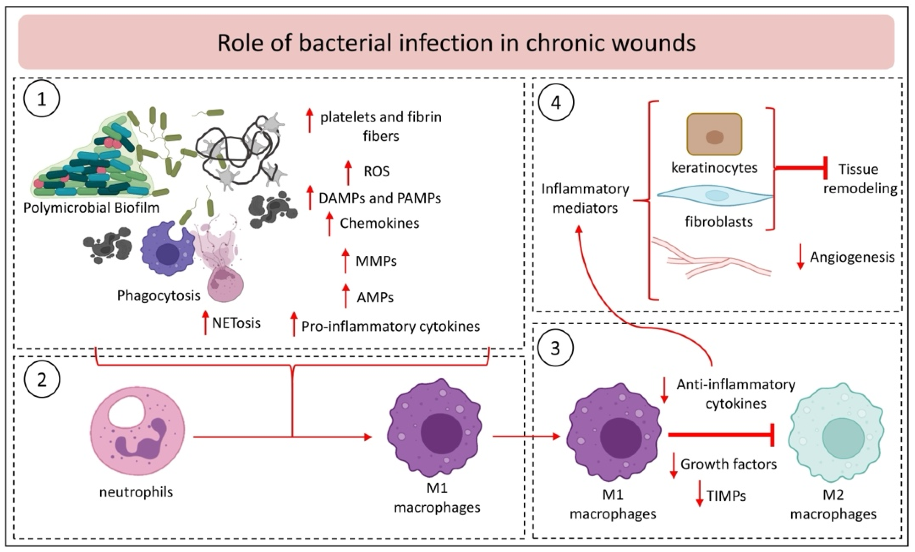 Ijms Free Full Text Chronic Inflammation In Non Healing Skin Wounds
