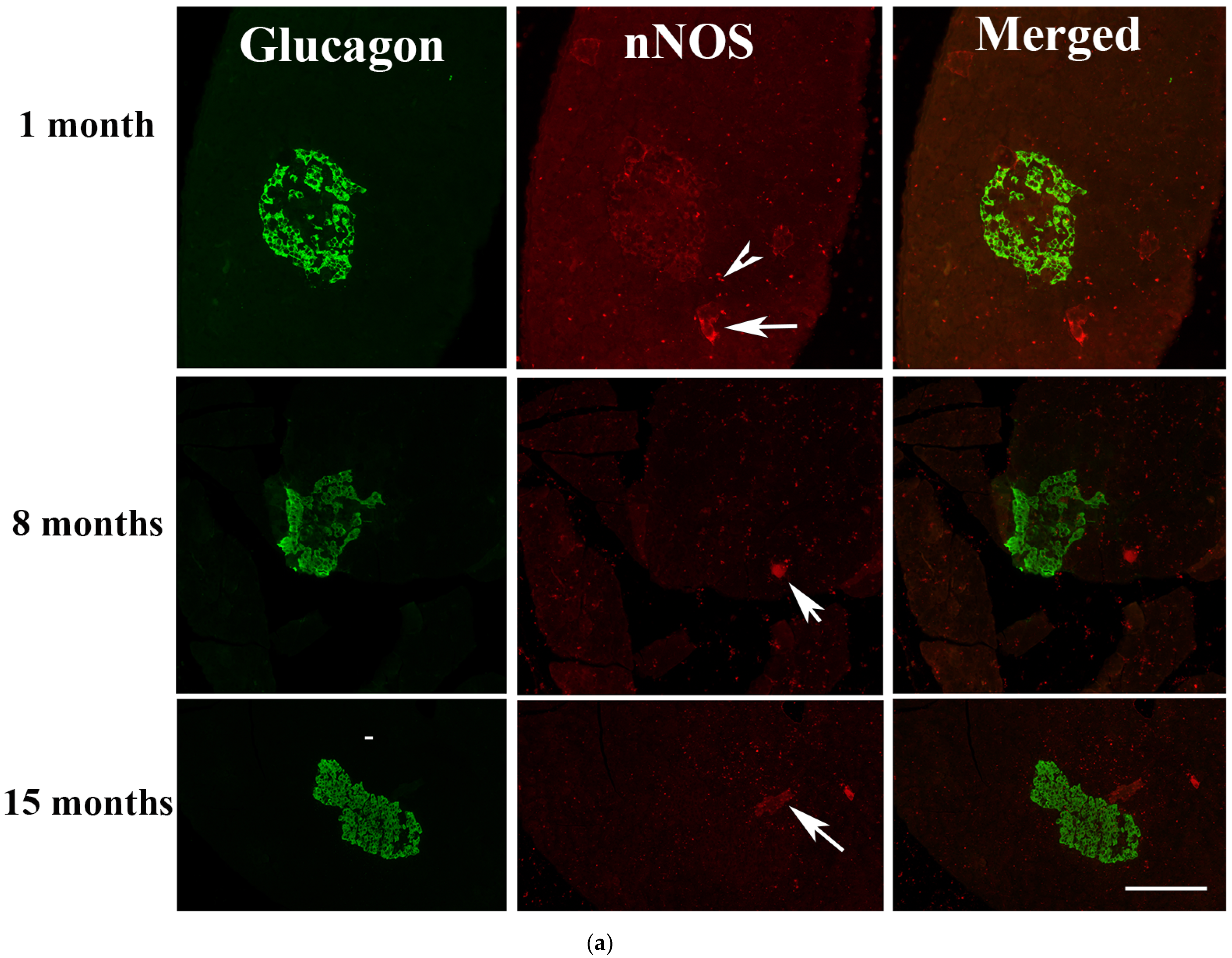 Ijms 23 04974 g008a