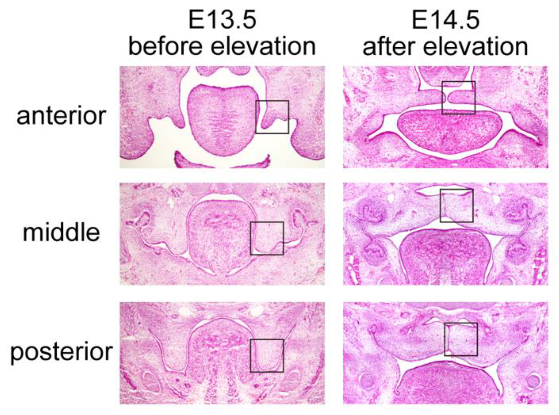 Spatiotemporal transcriptomic maps of whole mouse embryos at the