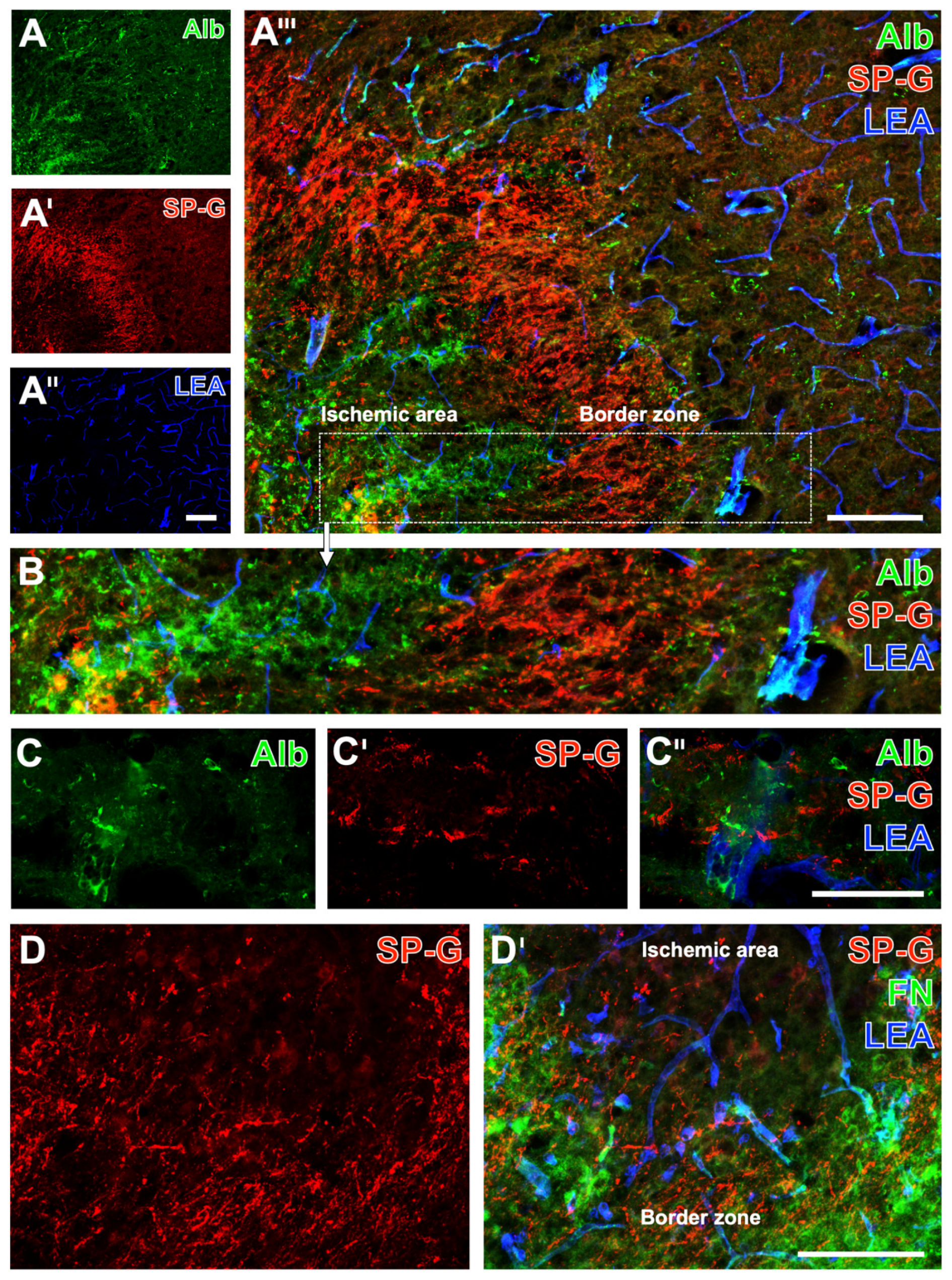 IJMS | Free Full-Text | Regionally Altered Immunosignals of Surfactant  Protein-G, Vascular and Non-Vascular Elements of the Neurovascular Unit  after Experimental Focal Cerebral Ischemia in Mice, Rats, and Sheep